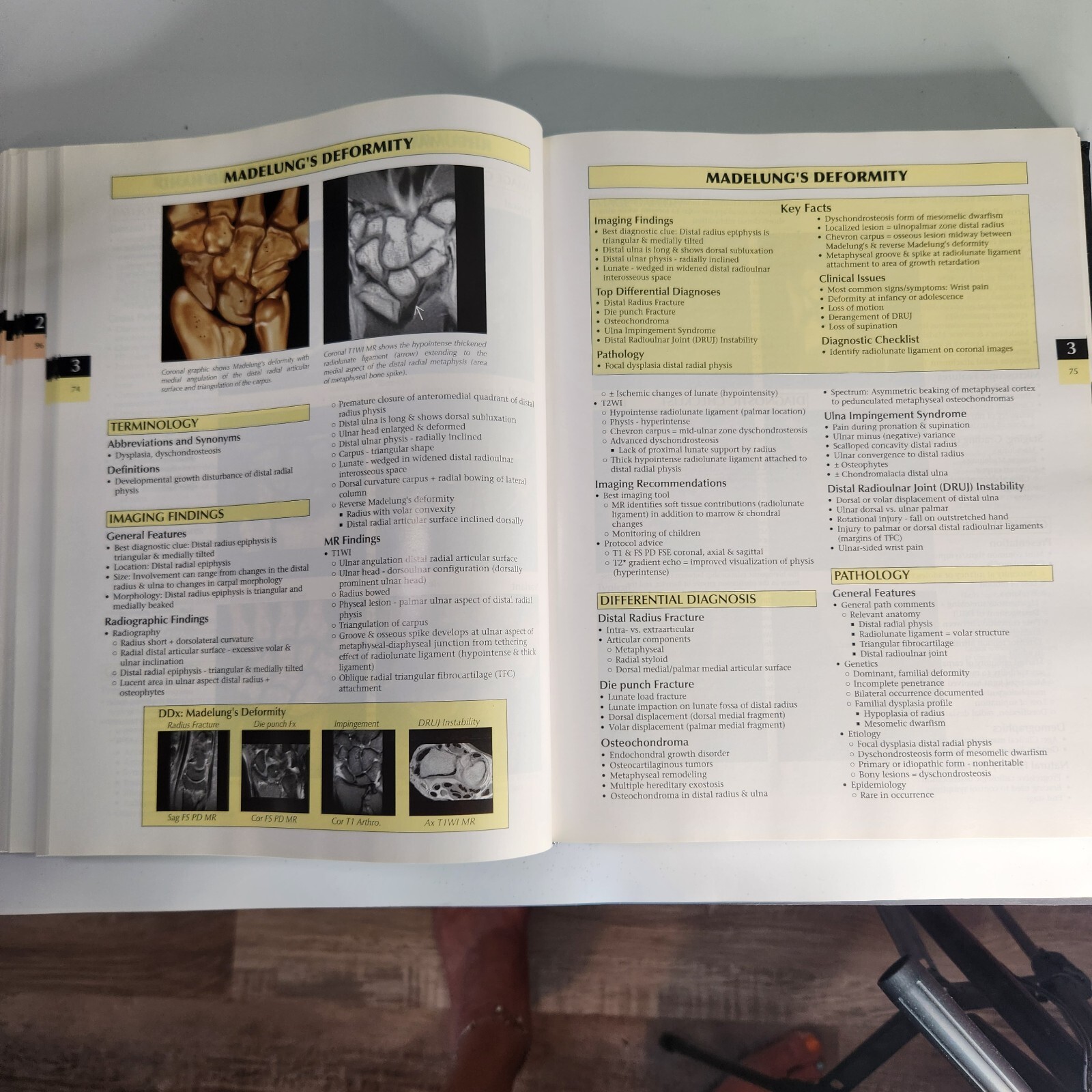 Diagnostic Imaging: Orthopaedics by Stoller, Tirman, Bredella MDRadiology Index