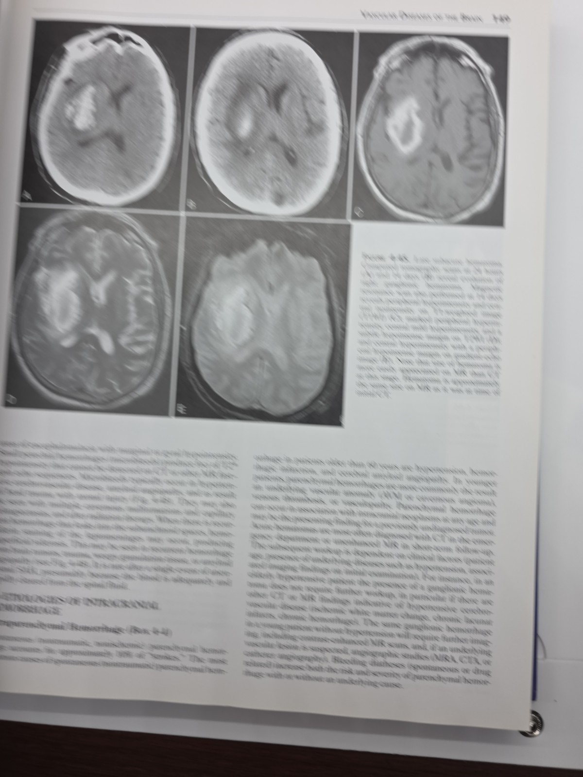 Requisites in Radiology: Neuroradiology by Robert D. Zimmerman, David M. Yousem