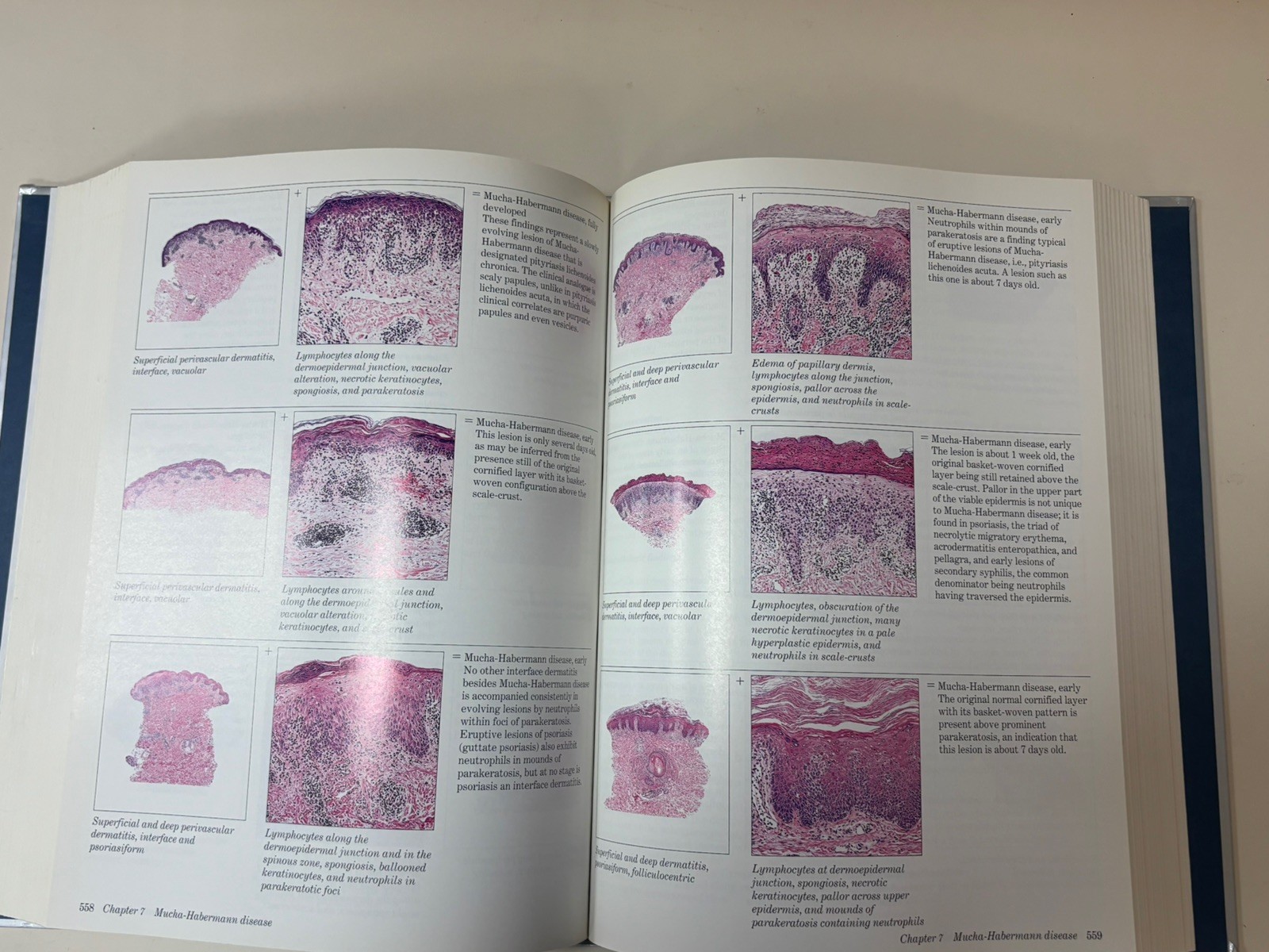 Histologic Diagnosis of Inflammatory Skin Diseases 2nd Ed 1997 good used cond.