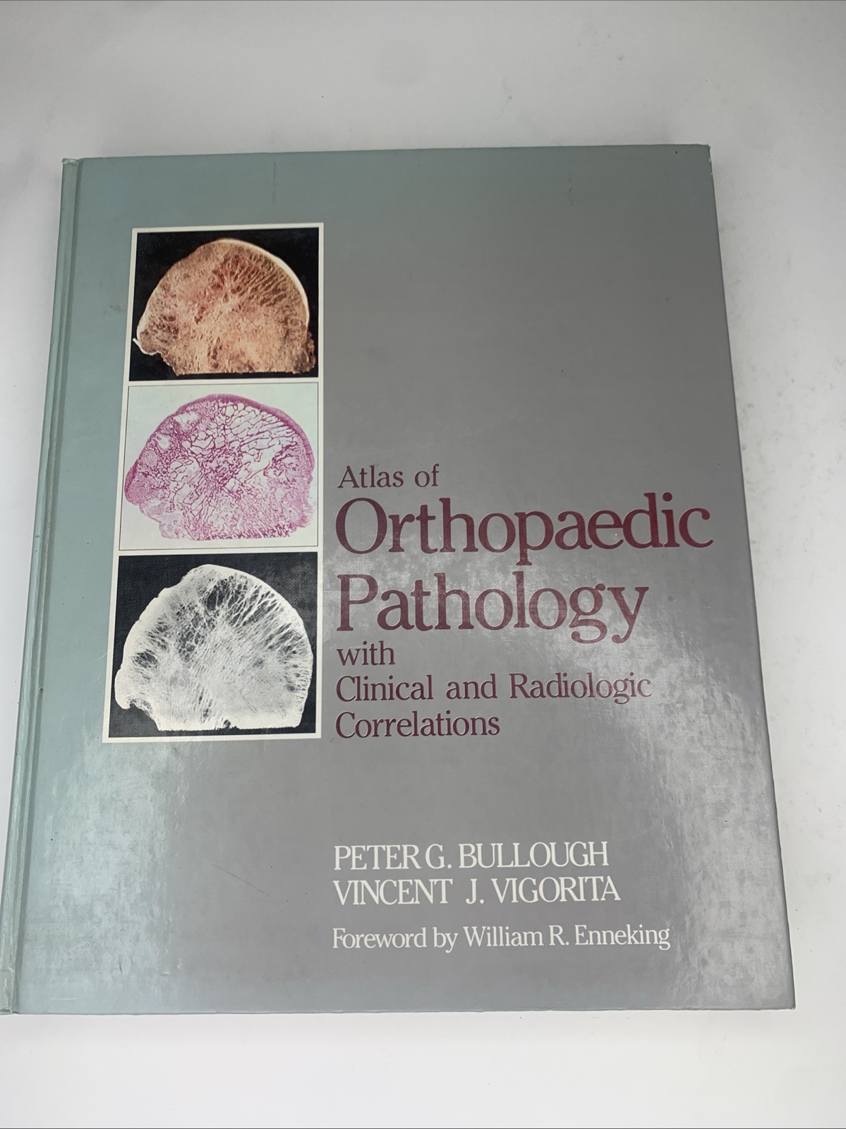 ATLAS OF ORTHOPEDIC PATHOLOGY: WITH CLINICAL AND By Peter G. Bullough & Vigorita