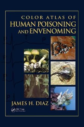 Color Atlas of Human Poisoning and Envenoming by Diaz James: Used
