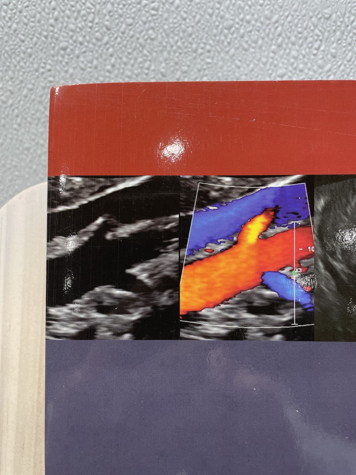 Sonography Scanning: Principles and Protocols by M. Robert deJong 5E Paperback