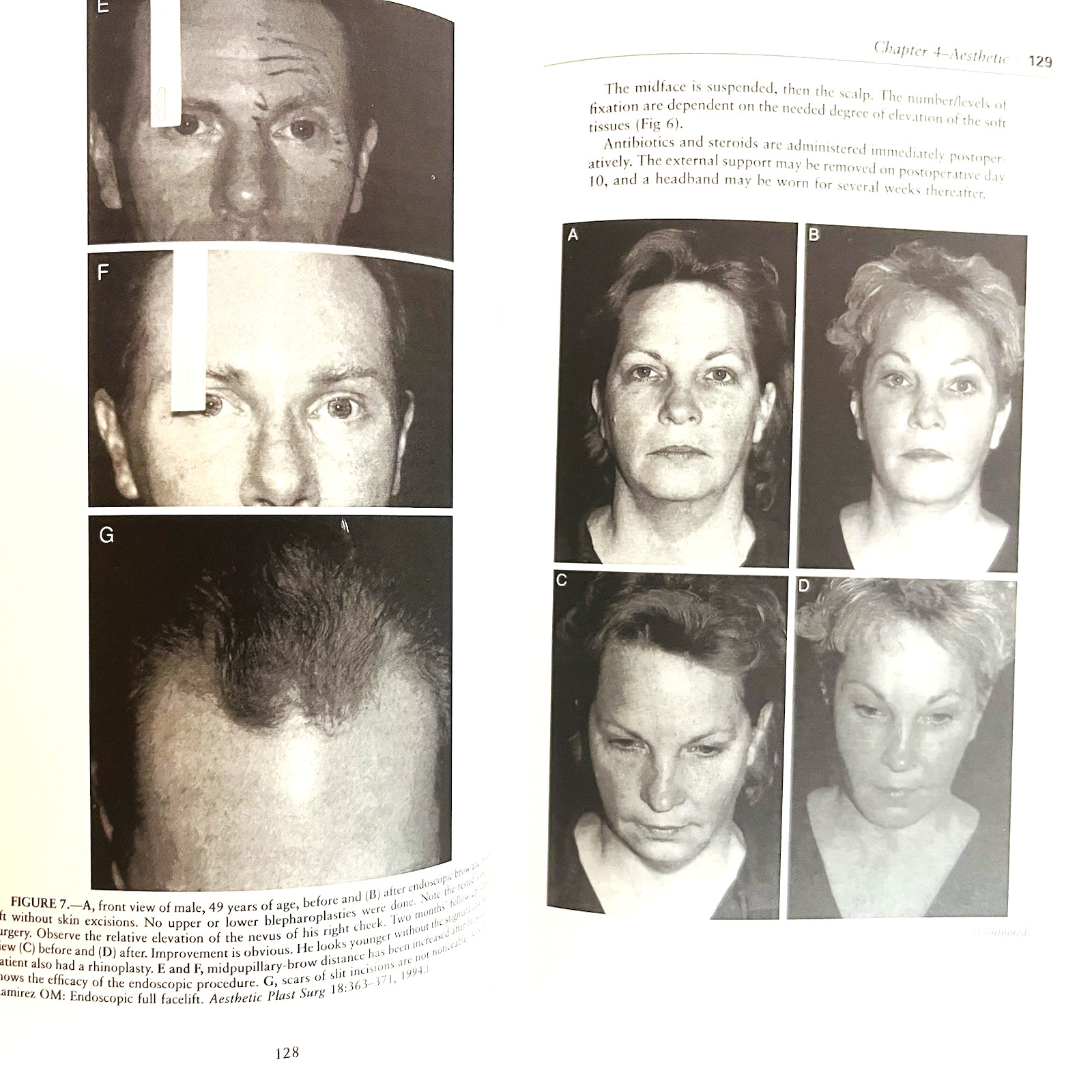 Vintage Year Book of Plastic And Reconstructive Surgery Book Hardcover 1997
