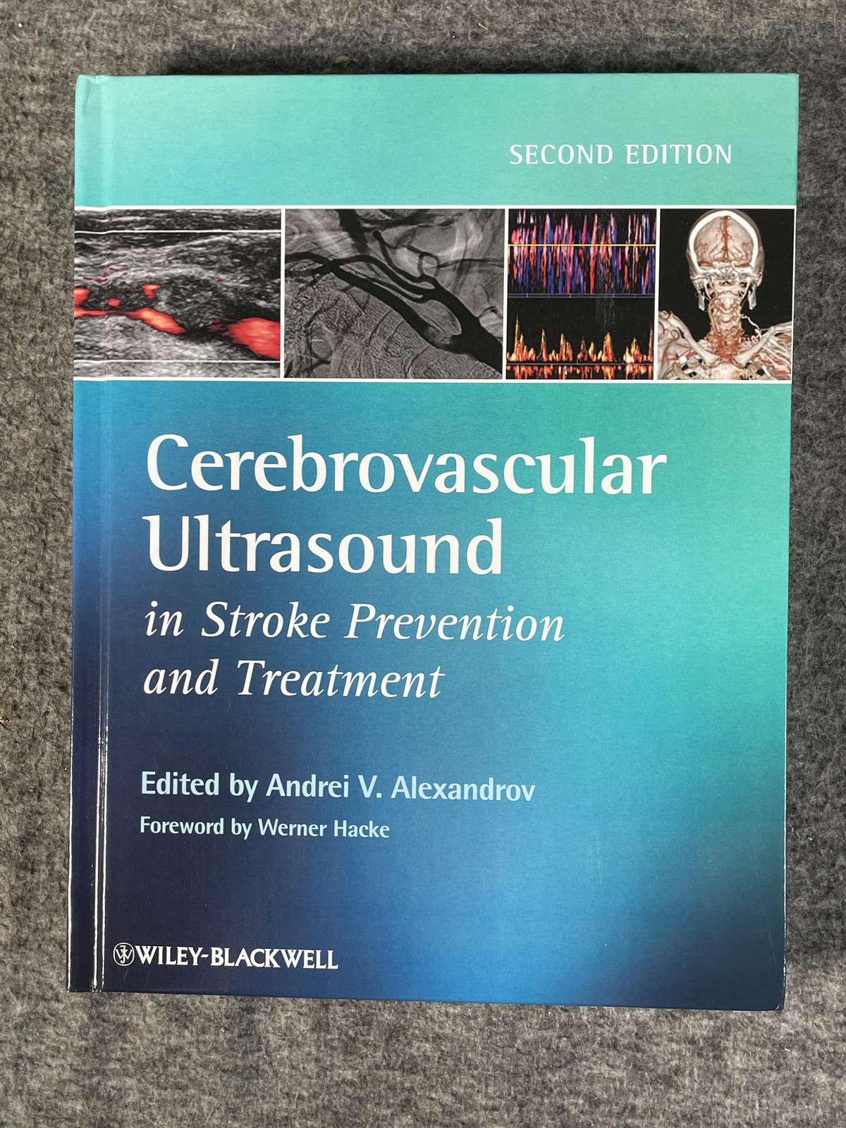 Cerebrovascular Ultrasound Stroke Prevention 2nd Ed Alexandrov Paperback