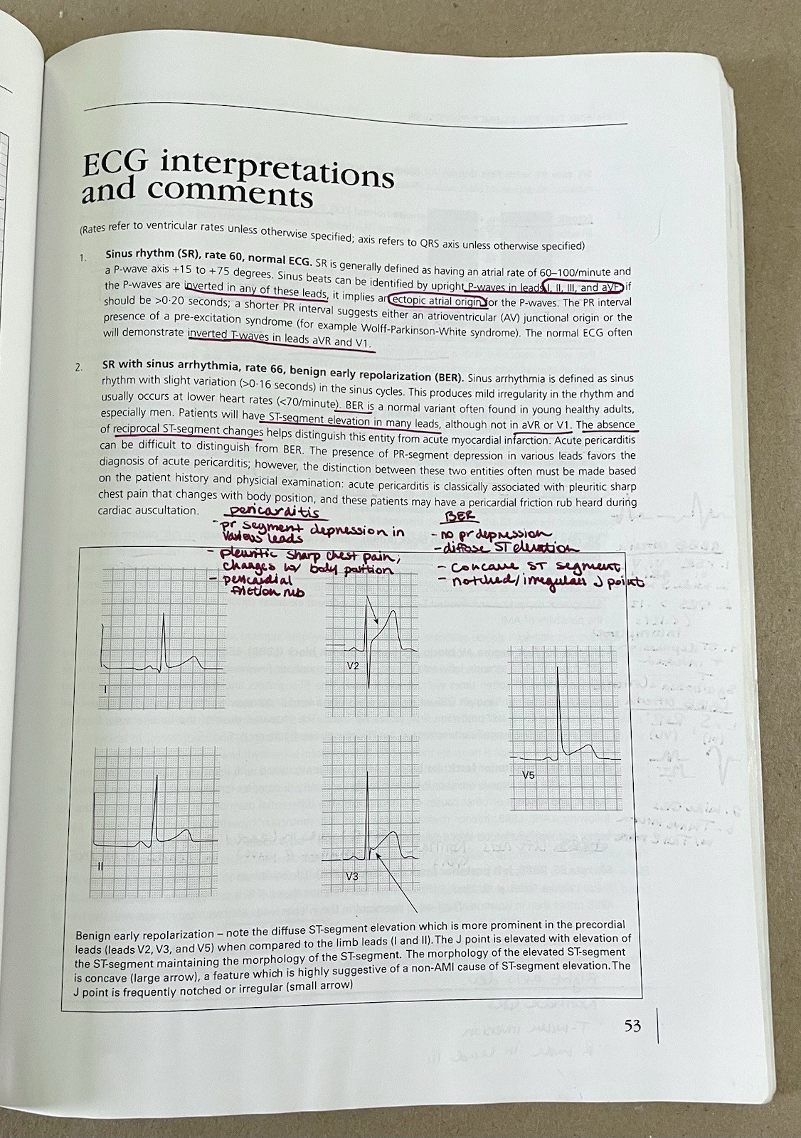 ECGs for the Emergency Physician 1, Amal Mattu & William Brady (2003, PB)