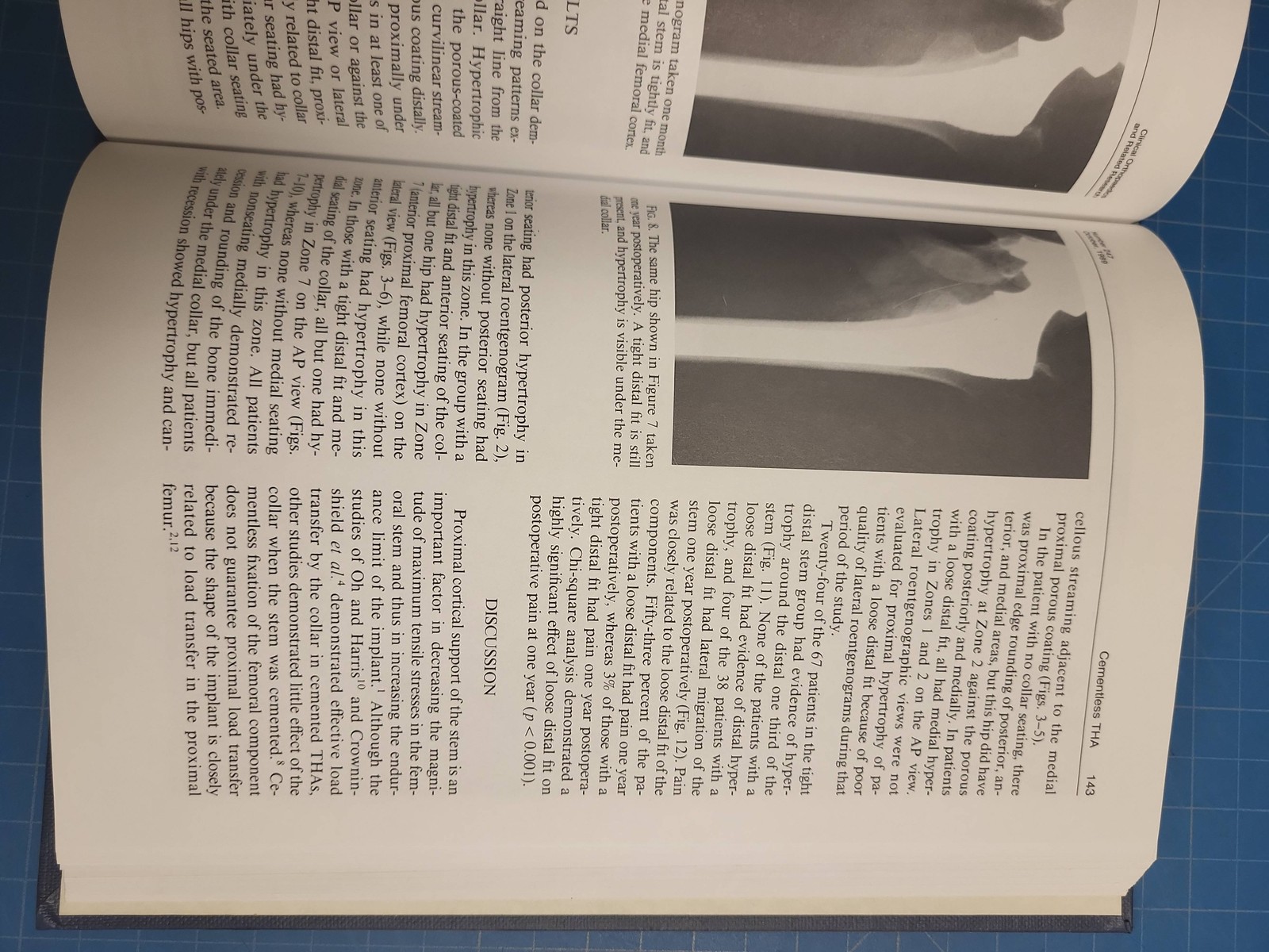 Clinical Orthopaedics Related Research No 247 Oct 1989 Pediatric Orthopedics