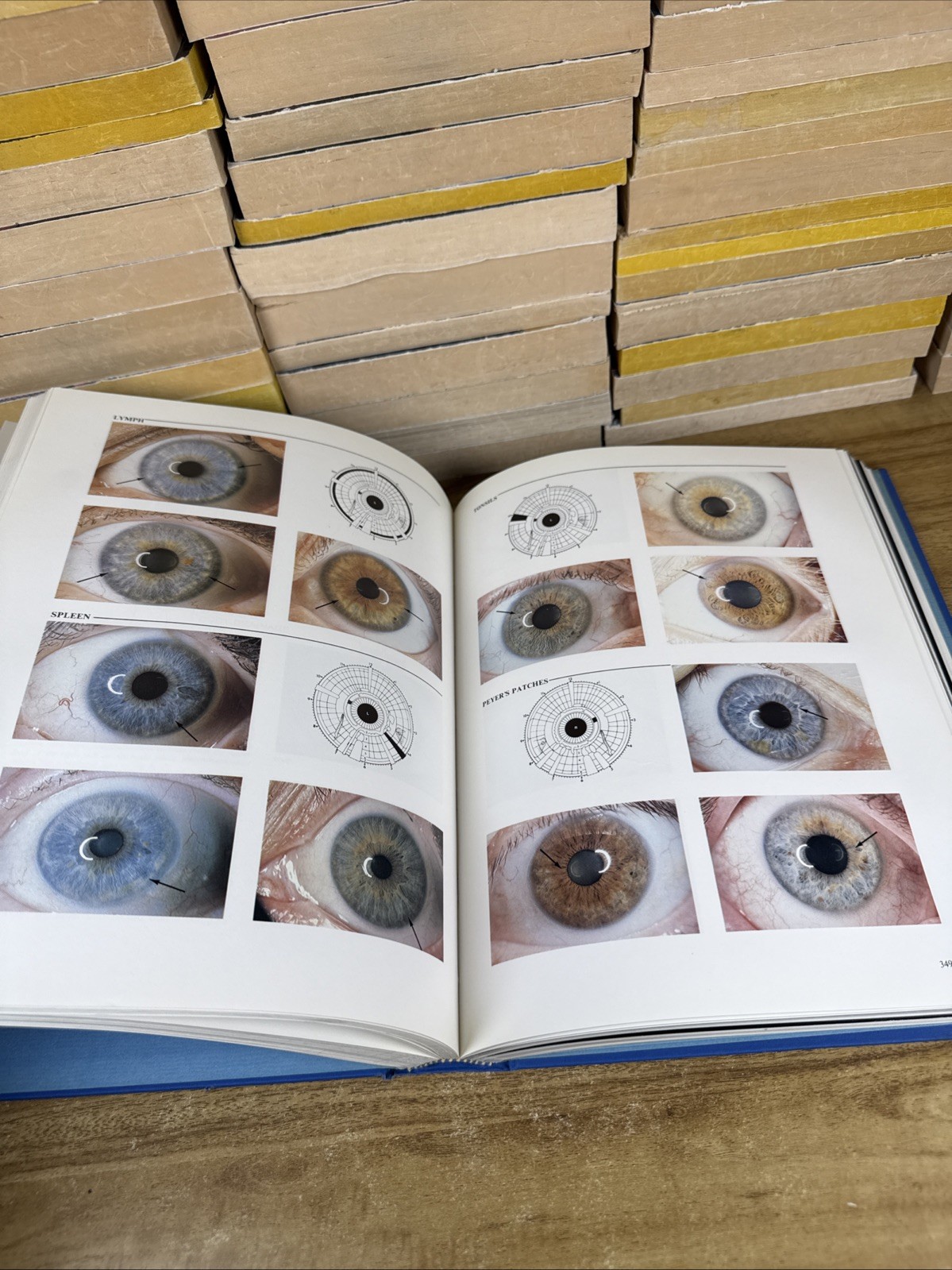 Iridology: The Science and Practice in the Healing Arts, Vol. 2 (1st Edition)