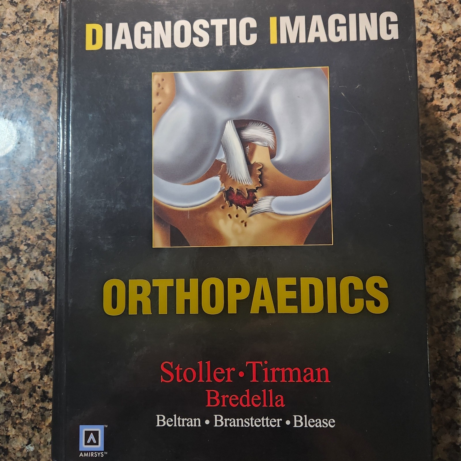 Diagnostic Imaging: Orthopaedics by Stoller, Tirman, Bredella MDRadiology Index