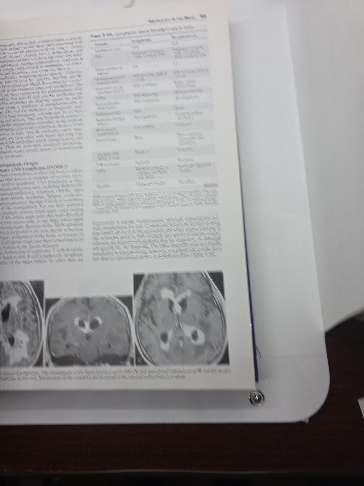 Requisites in Radiology: Neuroradiology by Robert D. Zimmerman, David M. Yousem