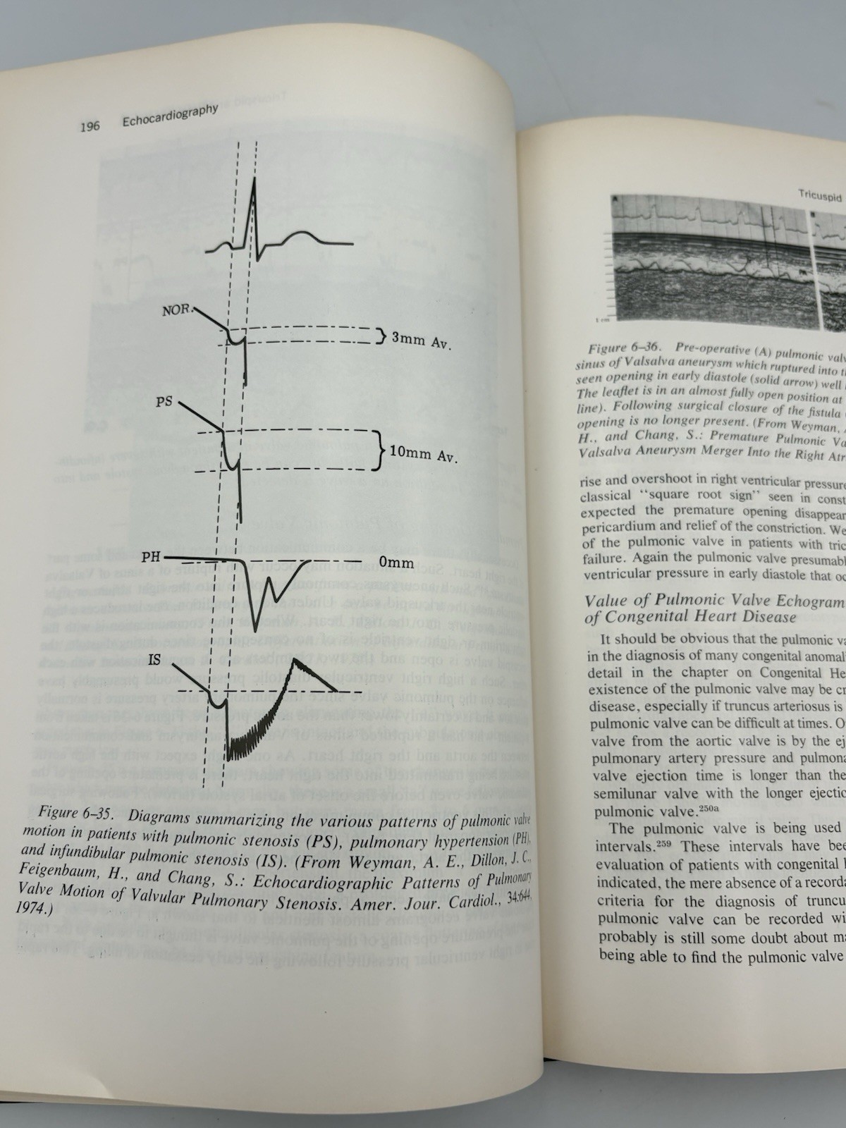 Echocardiography By Harvey Feinbaum (1976) Rare Vintage Hardcover