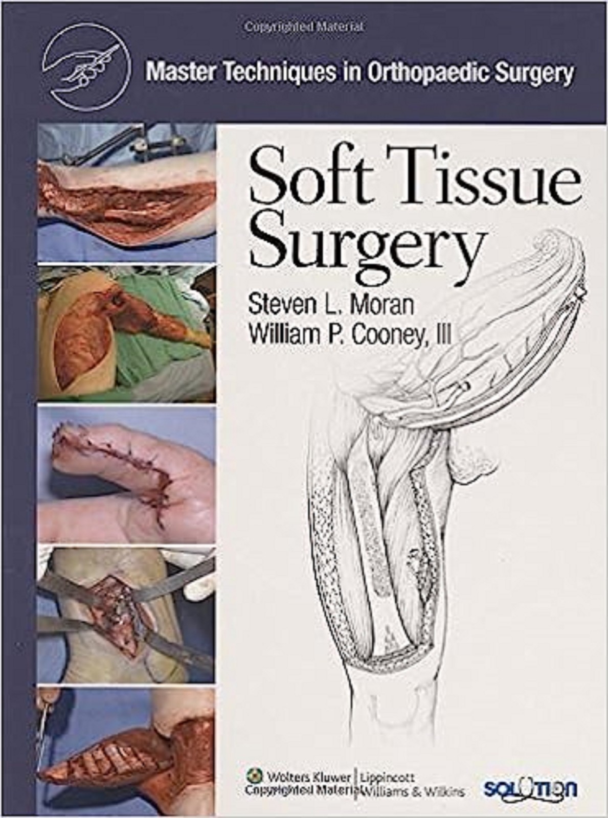 SHRINK-WRAPPED NEW INCLUDES CD: Soft Tissue Surgery 1st Edition HARDCOVER 2008