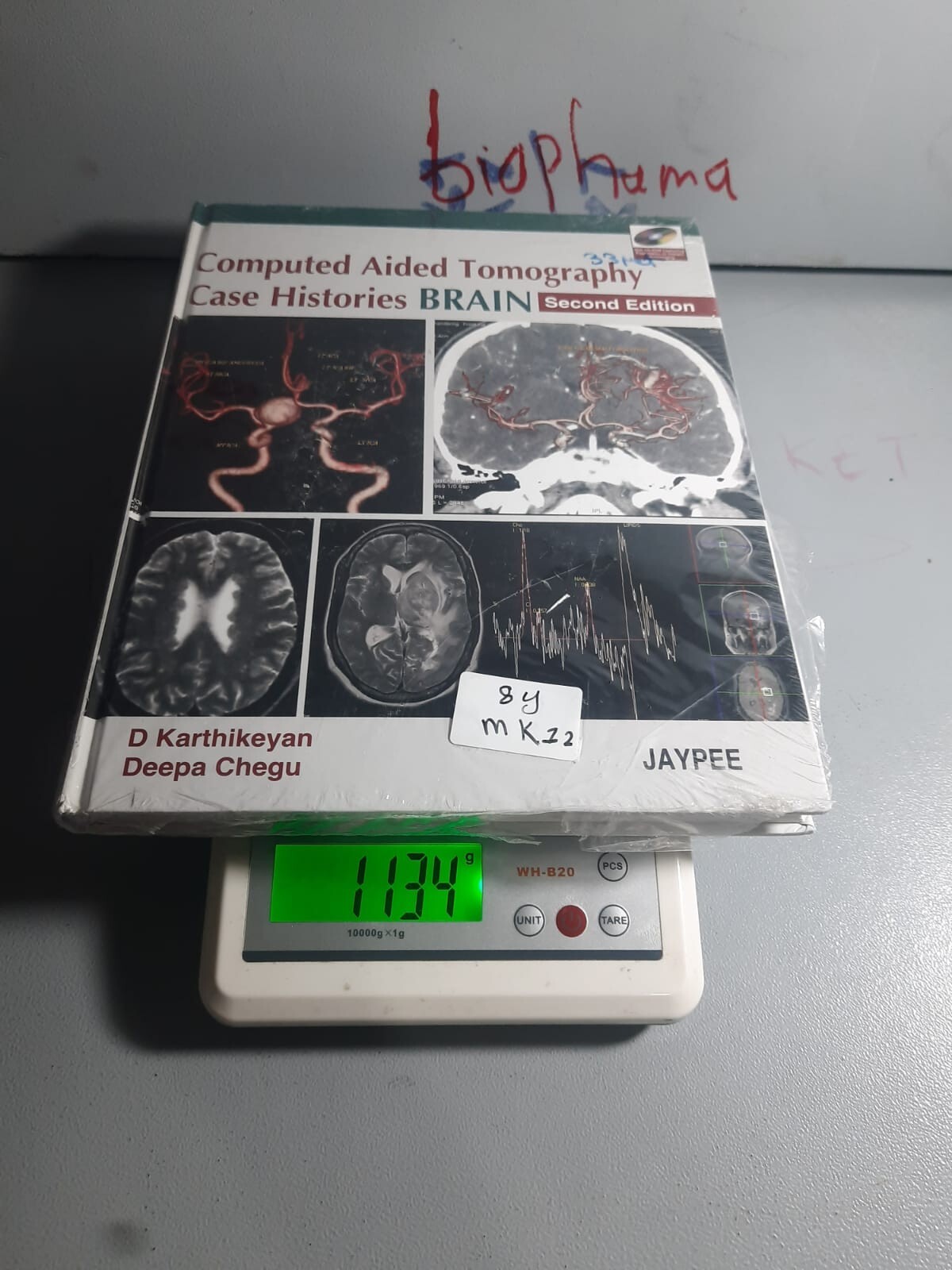 Computed Aided Tomography Case Histories BRAIN 