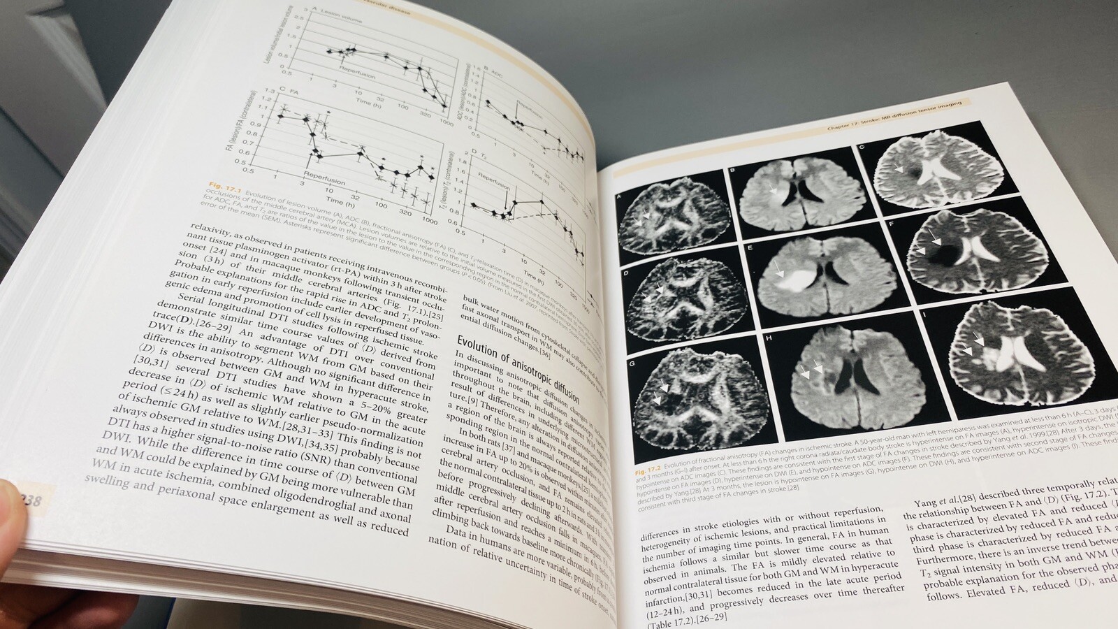 Clinical MR Neuroimaging Physiological and Functional Techniques Gillard Waldman