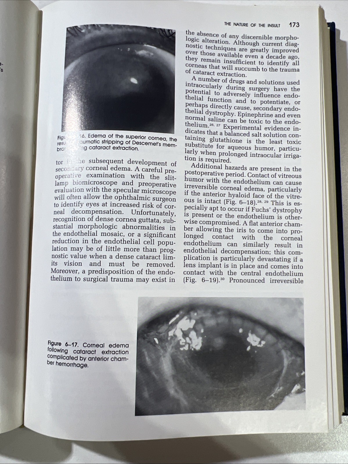 Corneal Disorders: Clinical Diagnosis and Management by Howard M. Leibowitz