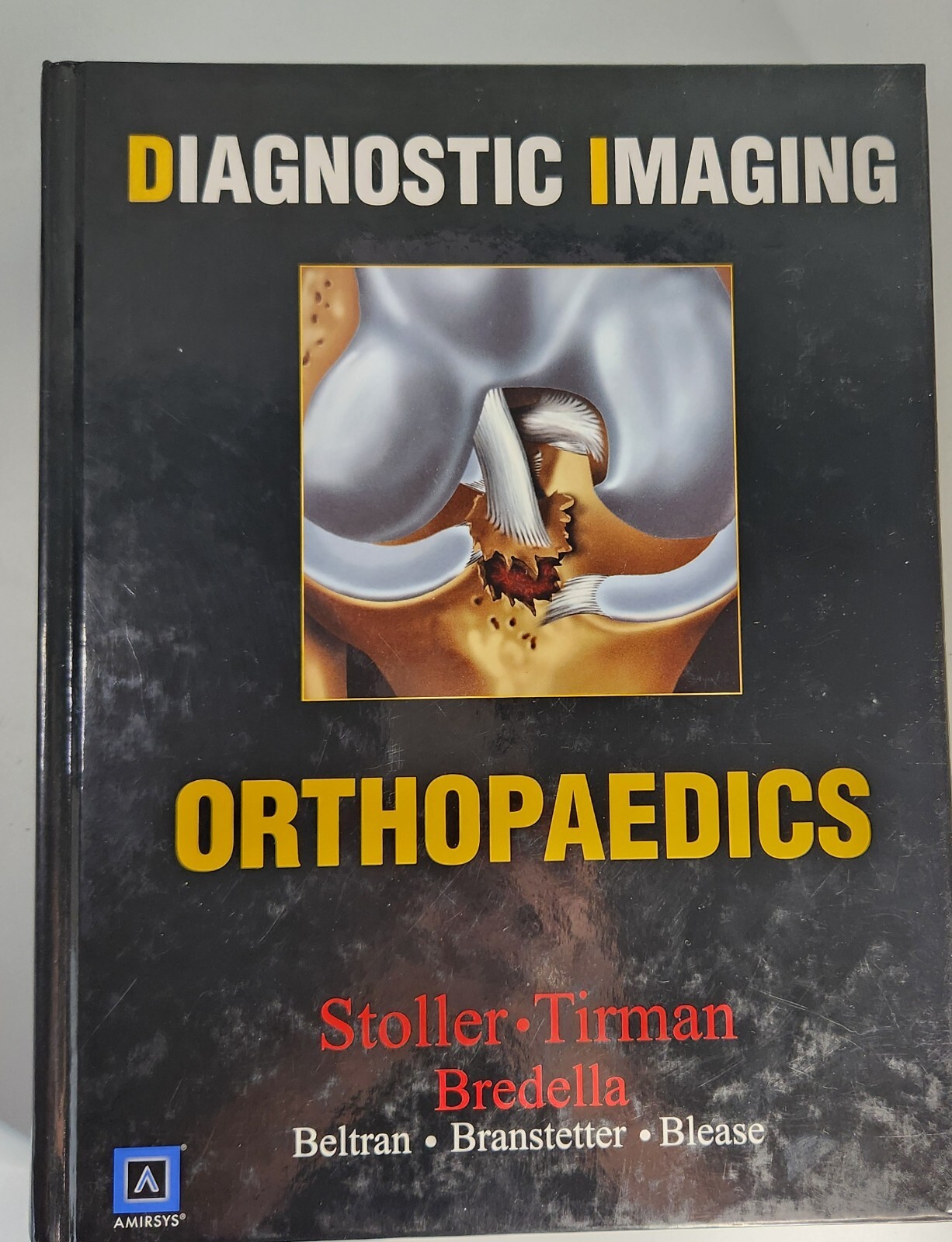 Diagnostic Imaging: Orthopaedics by Stoller, Tirman, Bredella MDRadiology Index