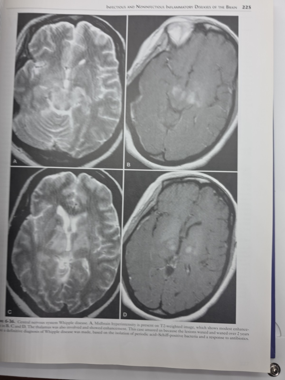 Requisites in Radiology: Neuroradiology by Robert D. Zimmerman, David M. Yousem