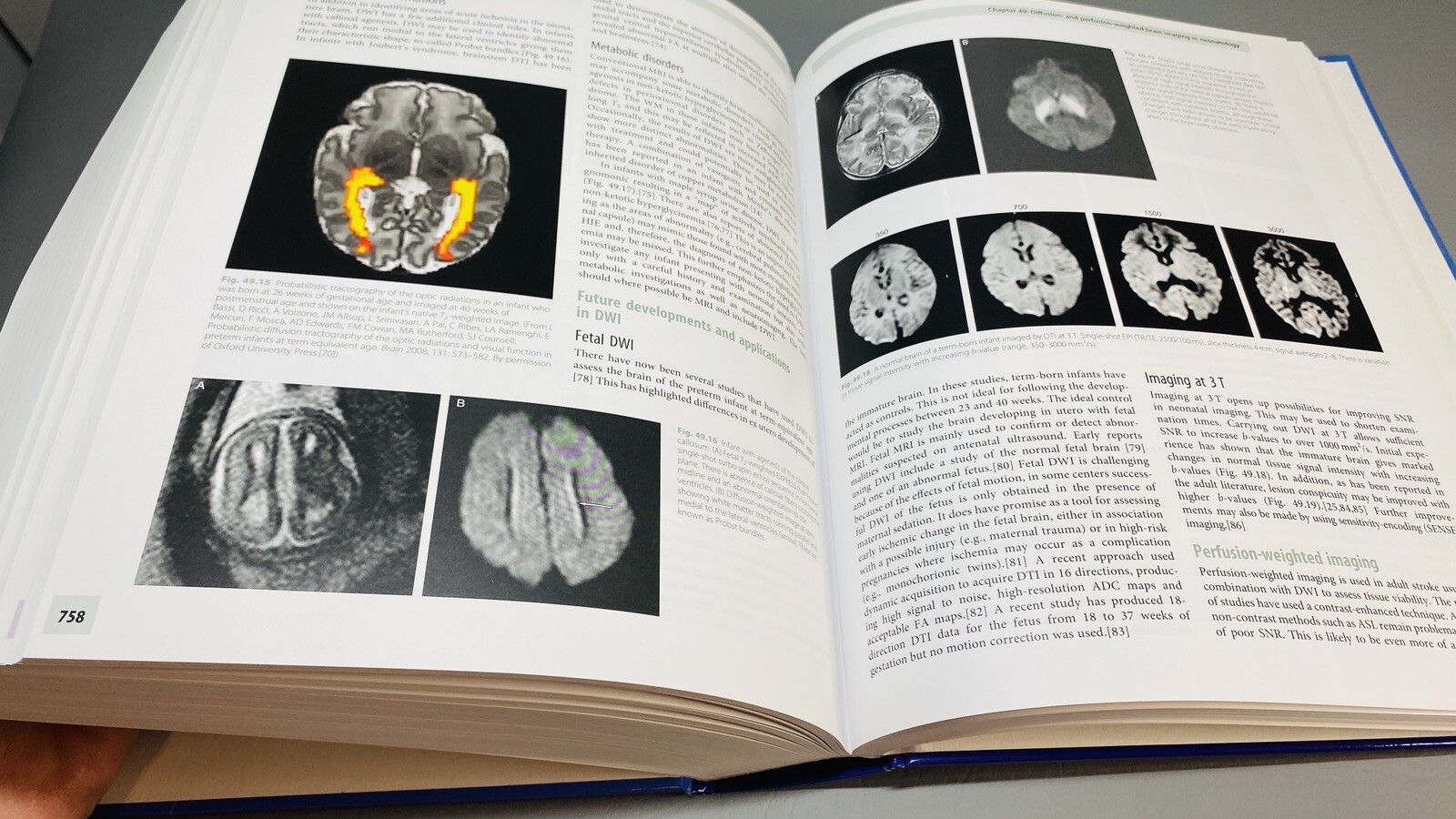 Clinical MR Neuroimaging Physiological and Functional Techniques Gillard Waldman