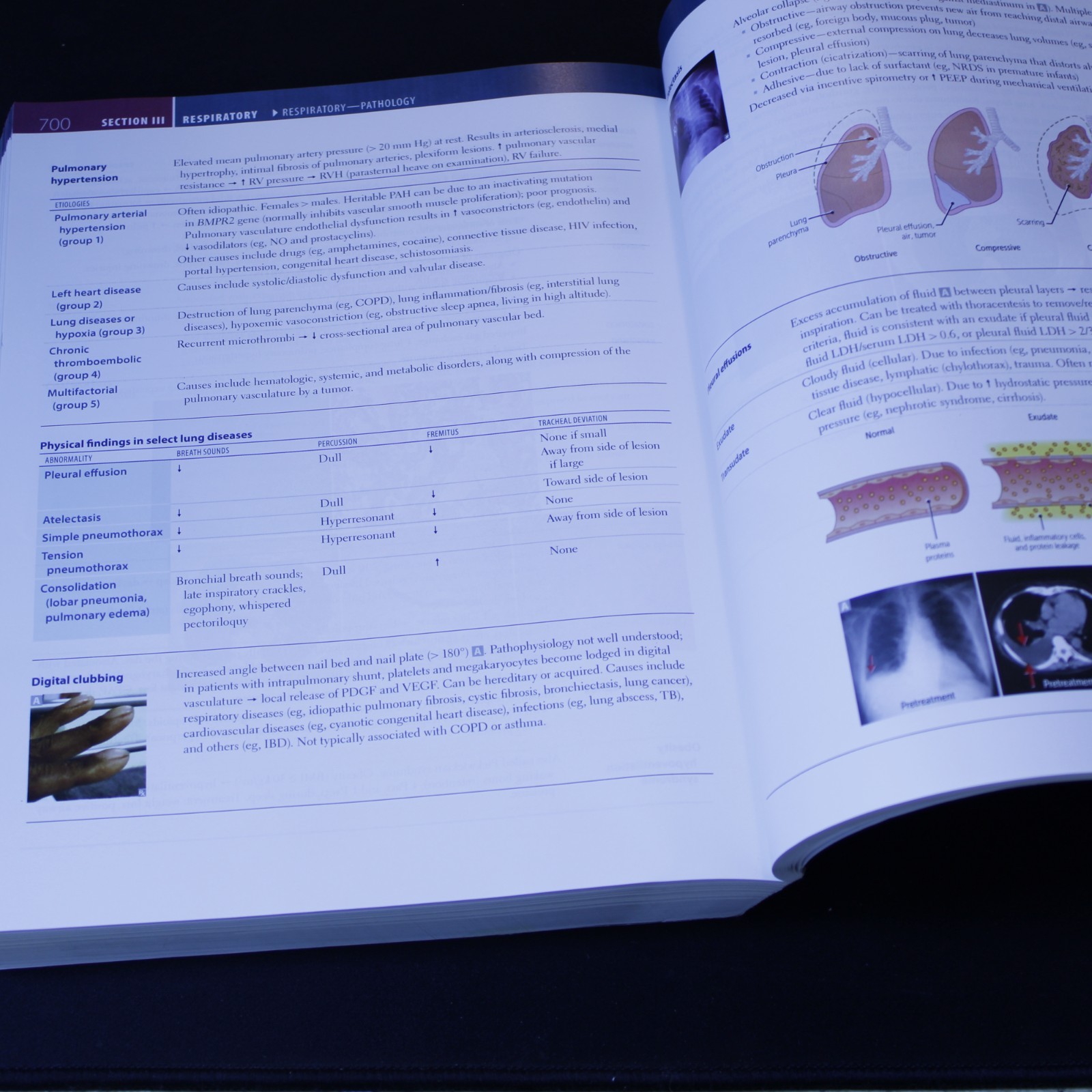 Master Your Medical Future with the Ultimate 2023 First Aid Paperback for USMLE