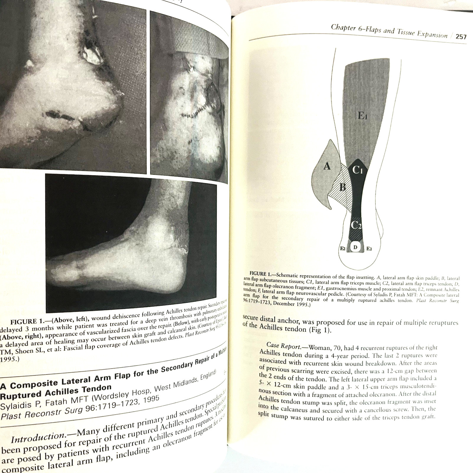 Vintage Year Book of Plastic And Reconstructive Surgery Book Hardcover 1997