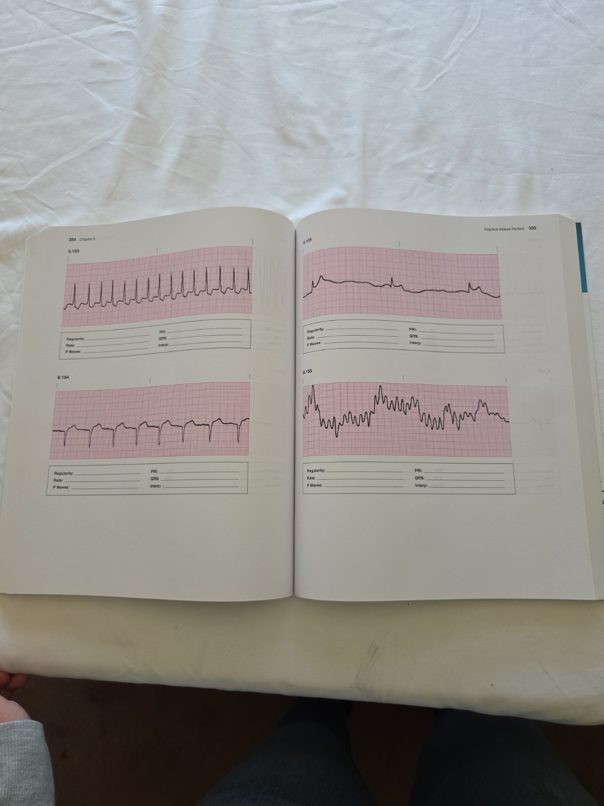 Basic Arrhythmias With 12-Lead EKGs 8th Edition Paperback By Walraven, Gail