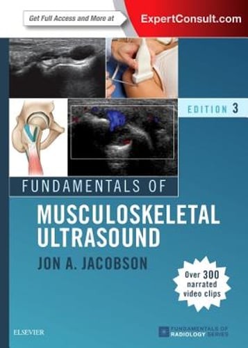 Fundamentals of Musculoskeletal Ultrasound by Jon A Jacobson: Used