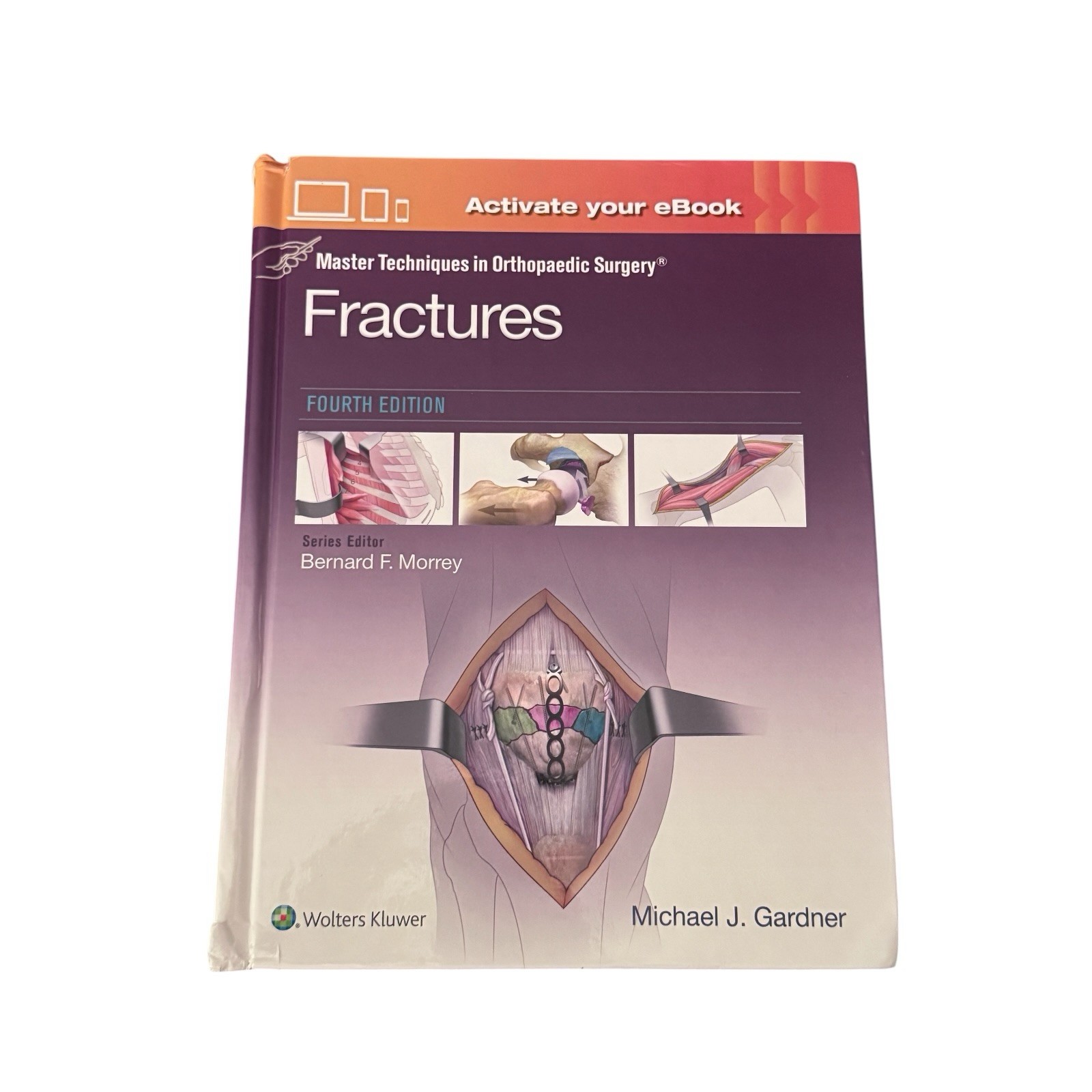 Master Techniques in Orthopaedic Surgery: Fractures Fourth Edition / With ebook