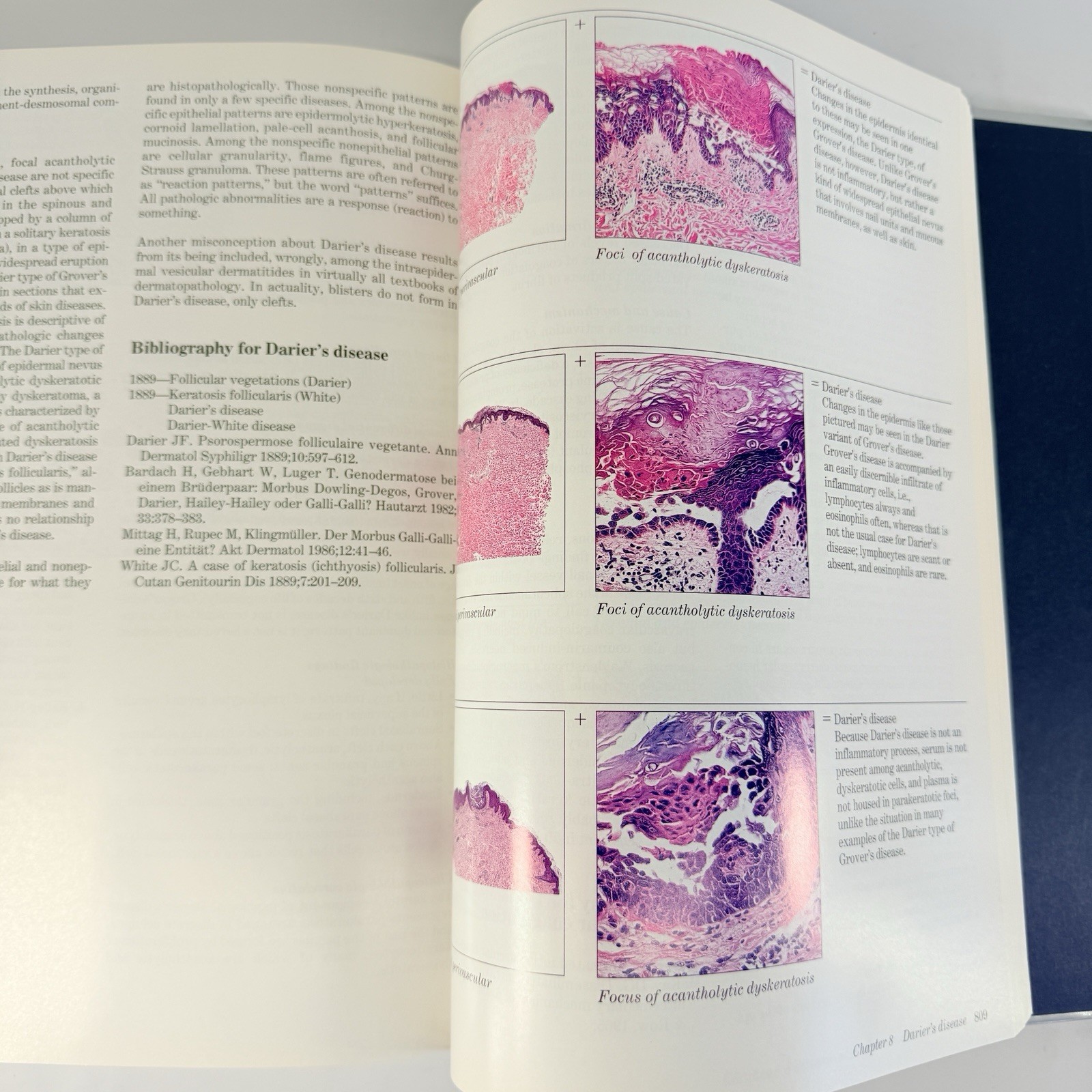 Histologic Diagnosis of Inflammatory Skin Diseases 2nd Ed Ackerman + Algorithms