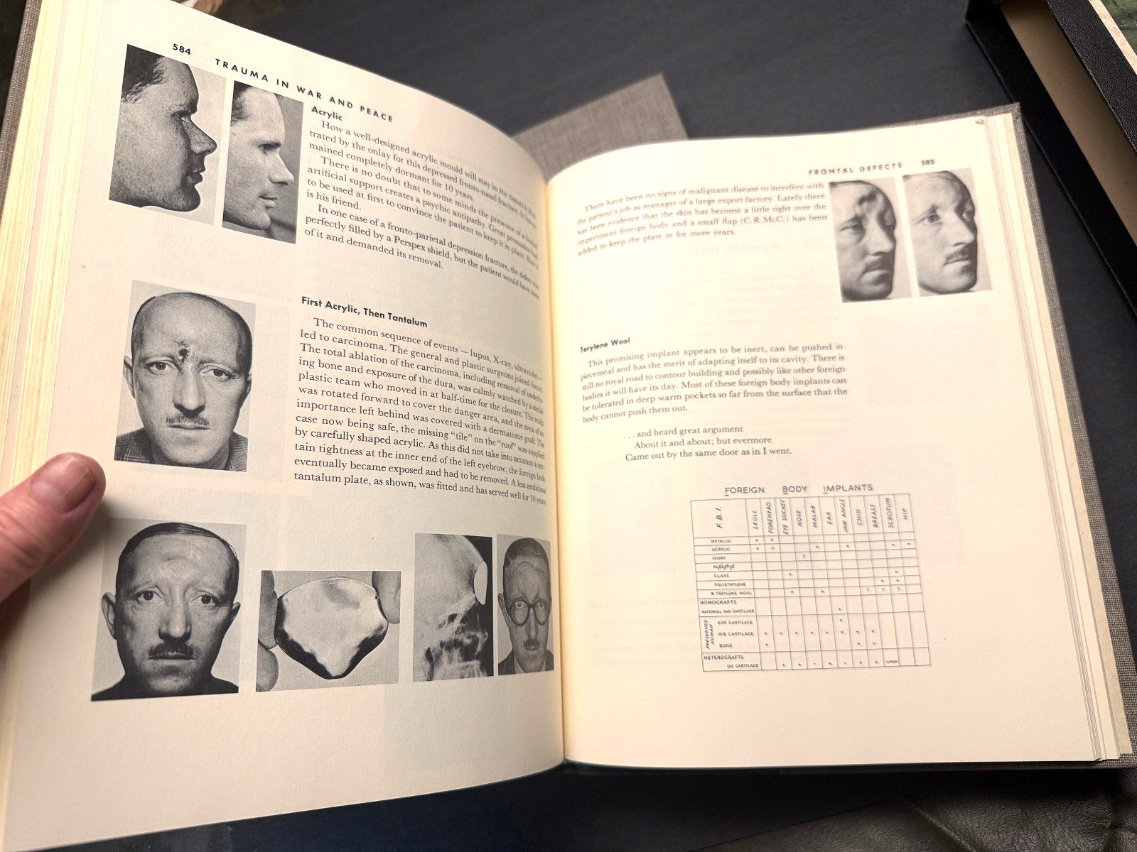THE PRINCIPLES AND ART OF PLASTIC SURGERY GILLIES & MILLARD 1ST EDITION SLIPCASE