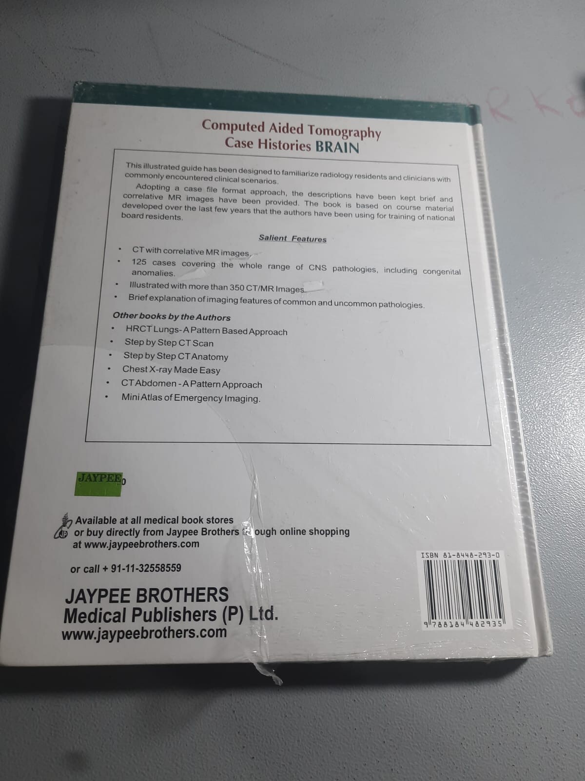 Computed Aided Tomography Case Histories BRAIN 