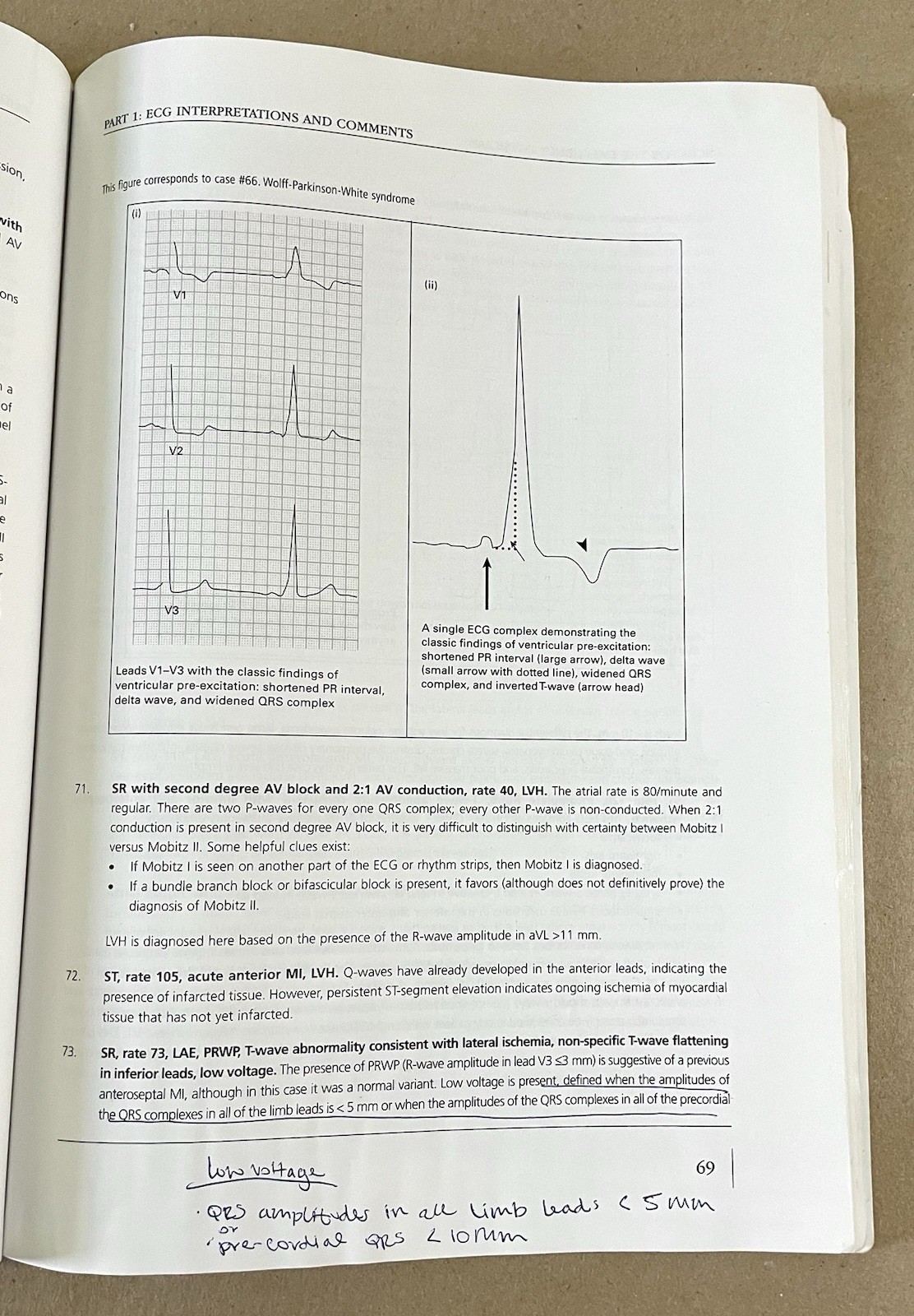 ECGs for the Emergency Physician 1, Amal Mattu & William Brady (2003, PB)