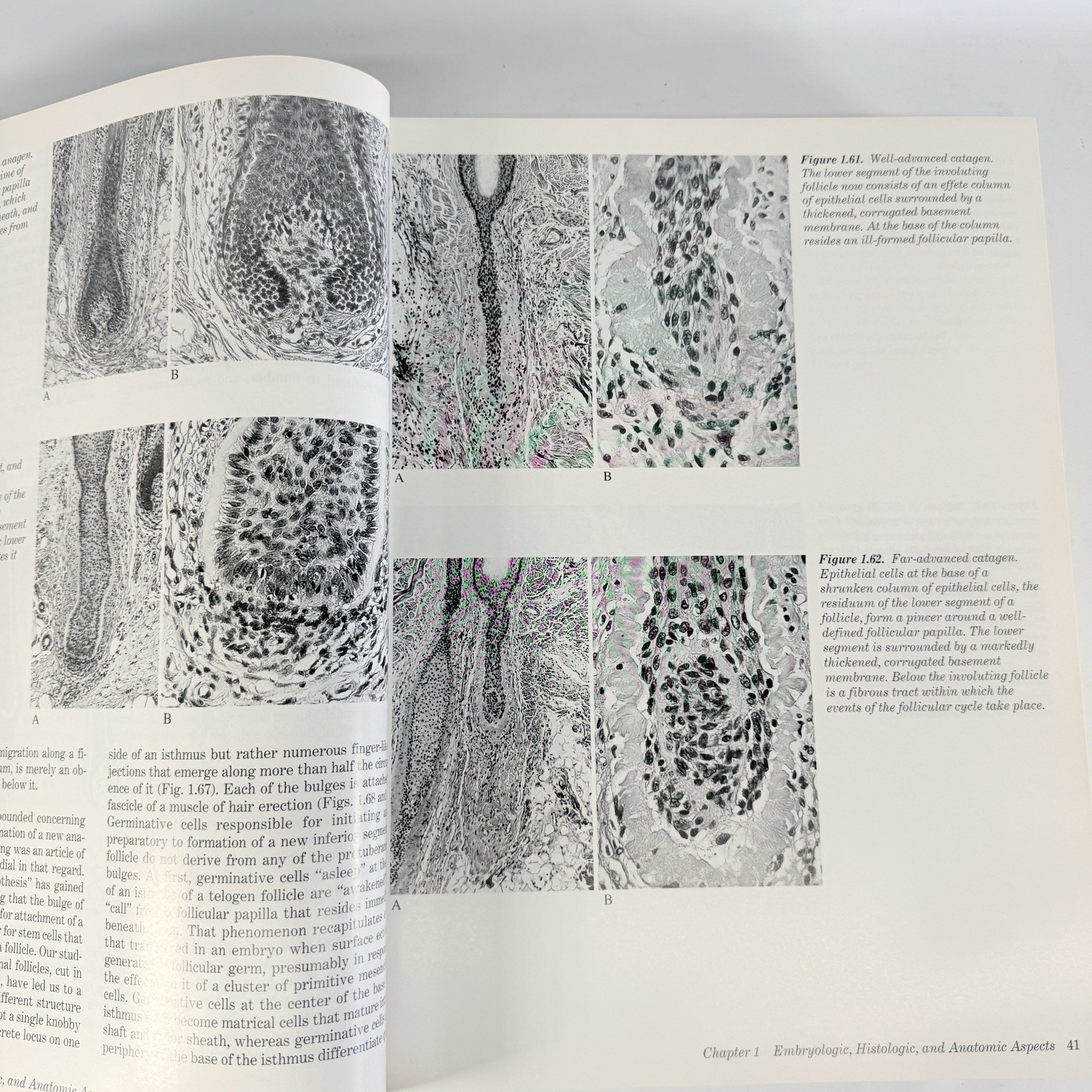 Histologic Diagnosis of Inflammatory Skin Diseases 2nd Ed Ackerman + Algorithms