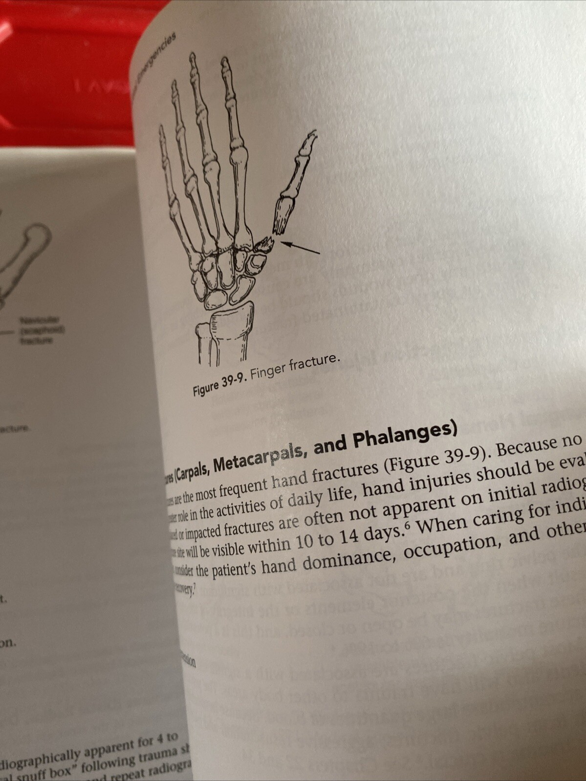 Sheehy’s Manual of Emergency Care by Emergency Nurses Association Staff…