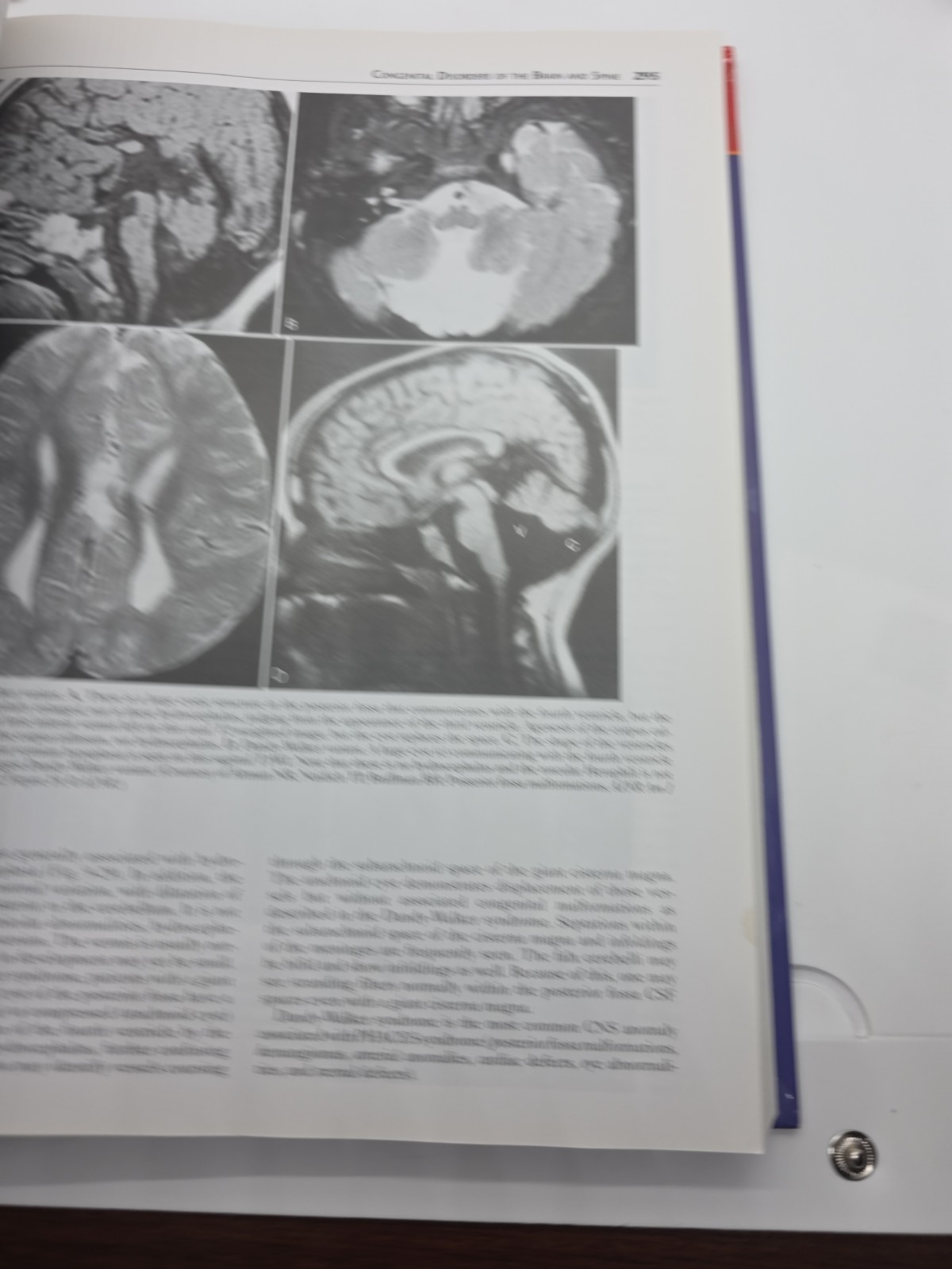 Requisites in Radiology: Neuroradiology by Robert D. Zimmerman, David M. Yousem