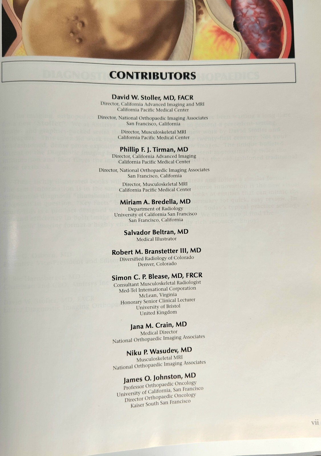Diagnostic Imaging: Orthopaedics by Stoller, Tirman, Bredella MDRadiology Index