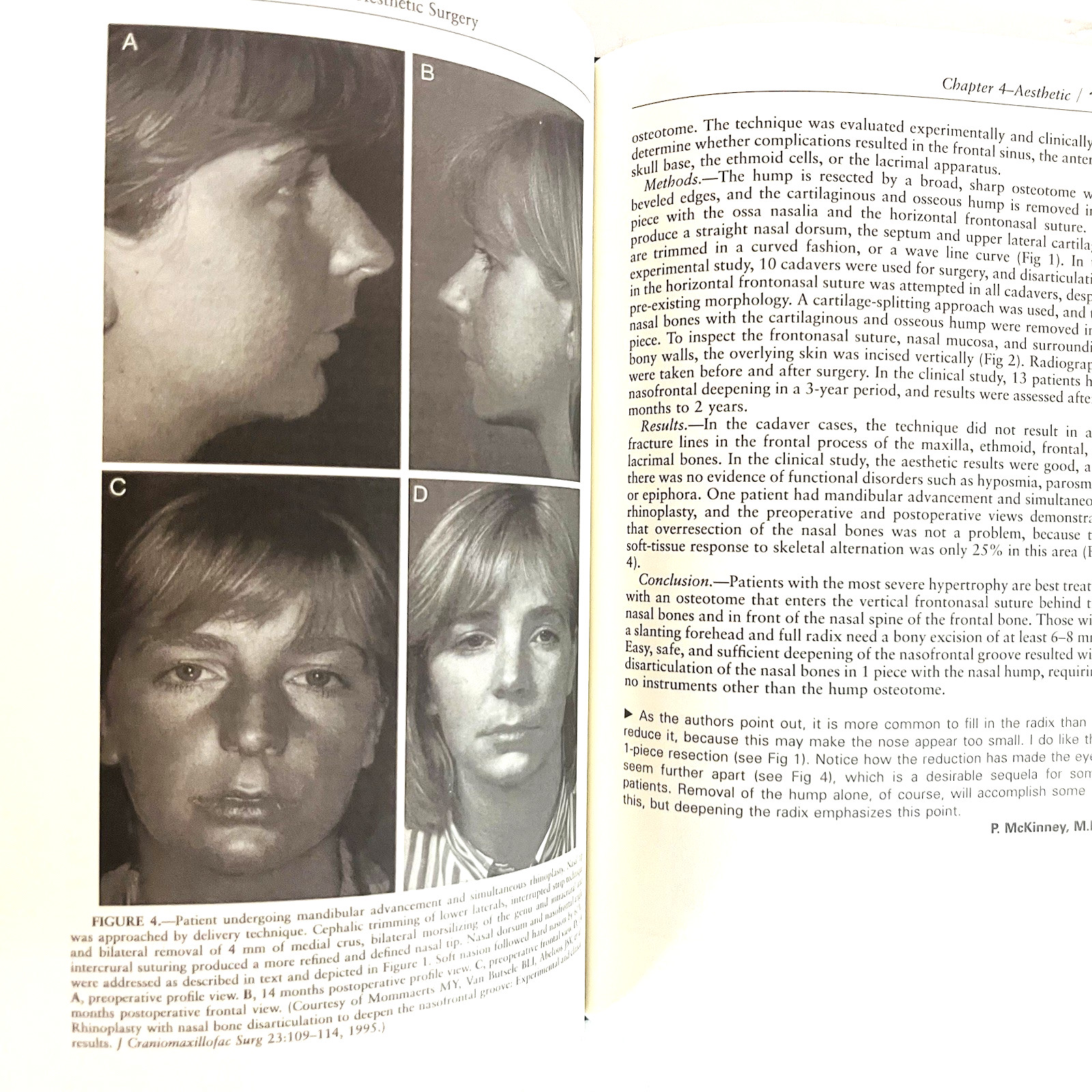 Vintage Year Book of Plastic And Reconstructive Surgery Book Hardcover 1997