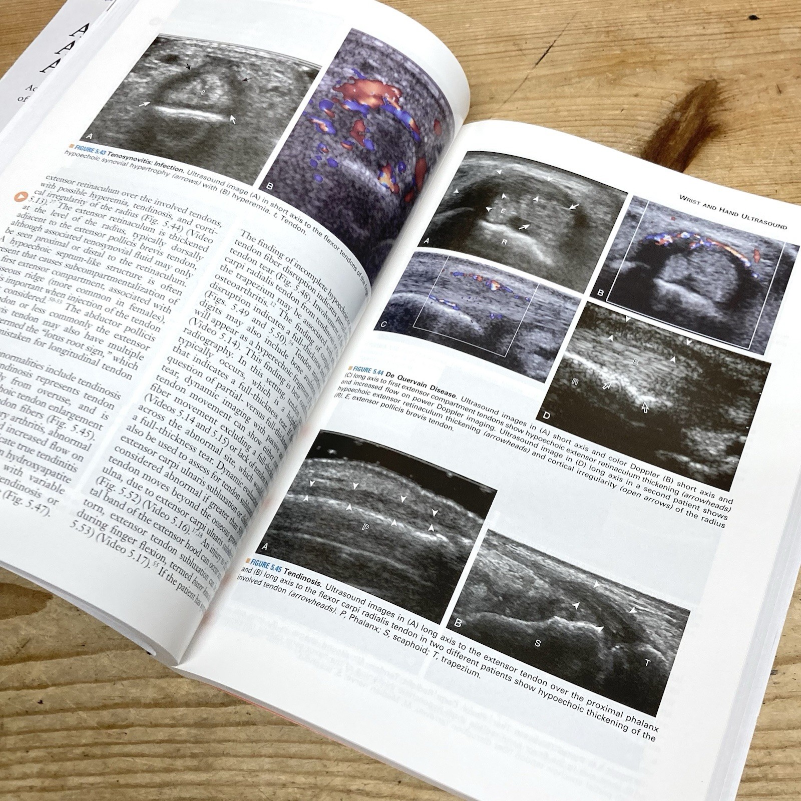Fundamentals of Musculoskeletal Ultrasound (Fundamentals of Radiology) 3rd Ed