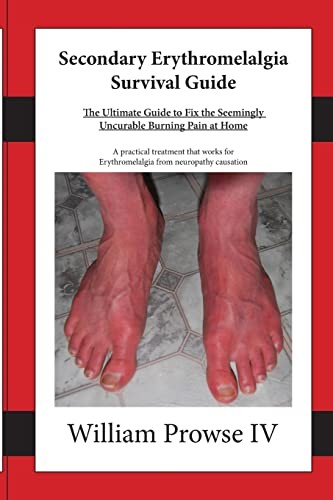 Secondary Erythromelalgia Surv – VERY GOOD