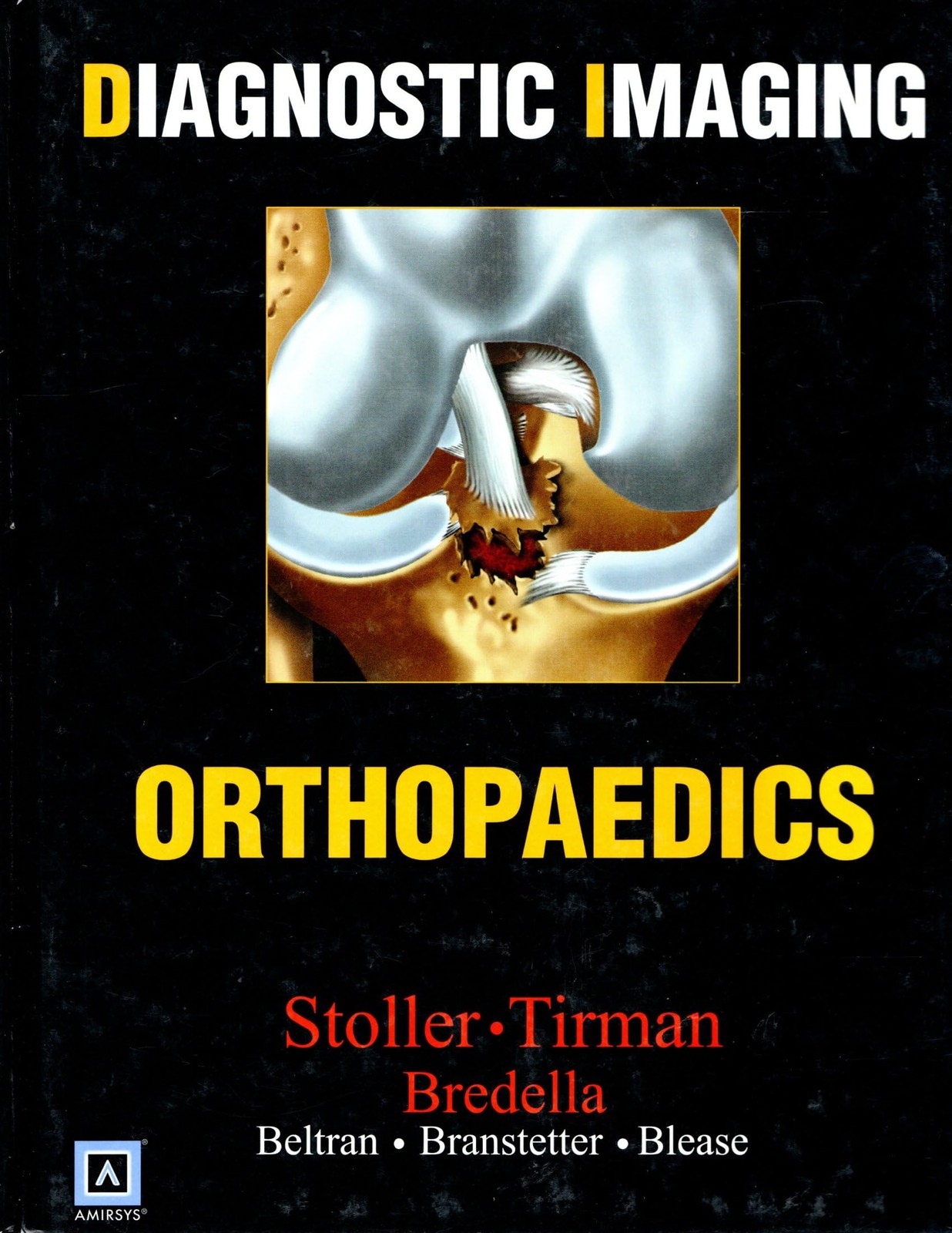 Diagnostic Imaging: Orthopaedics – hardcover Phillip Tirman|Miriam Bredella|…