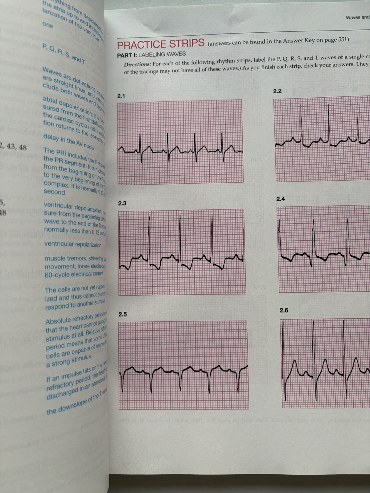 Basic Arrhythmias With 12-Lead EKGs Gail Walraven 2016 Paperback Eighth Edition