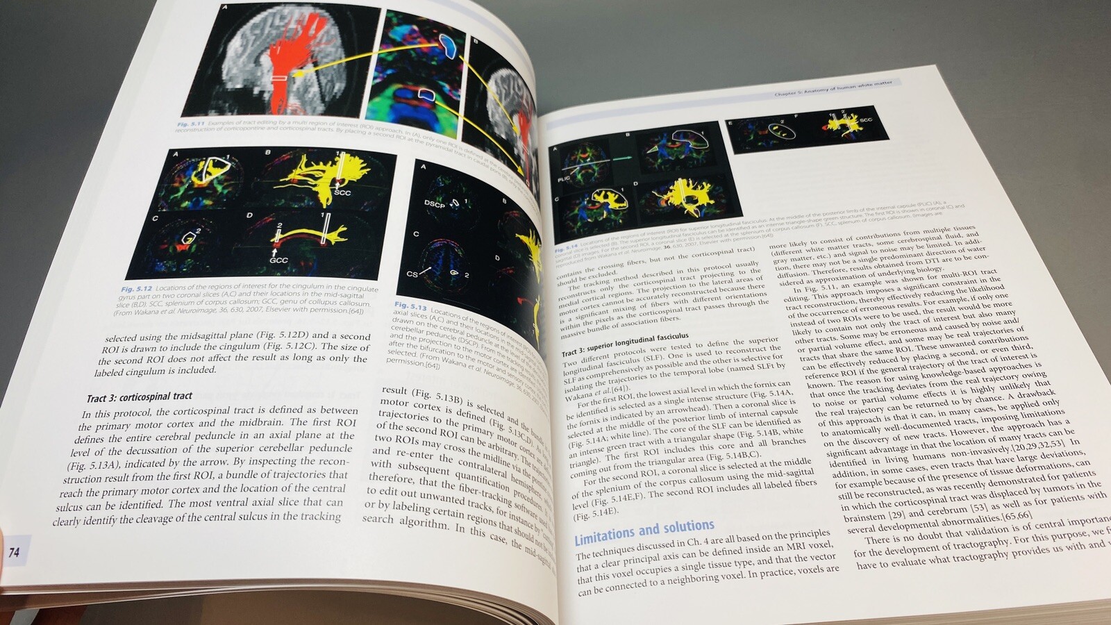 Clinical MR Neuroimaging Physiological and Functional Techniques Gillard Waldman
