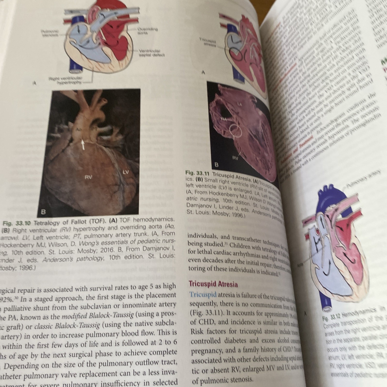 McCance & Huether’s – Hardcover, by Rogers DNP APRN – Very Good