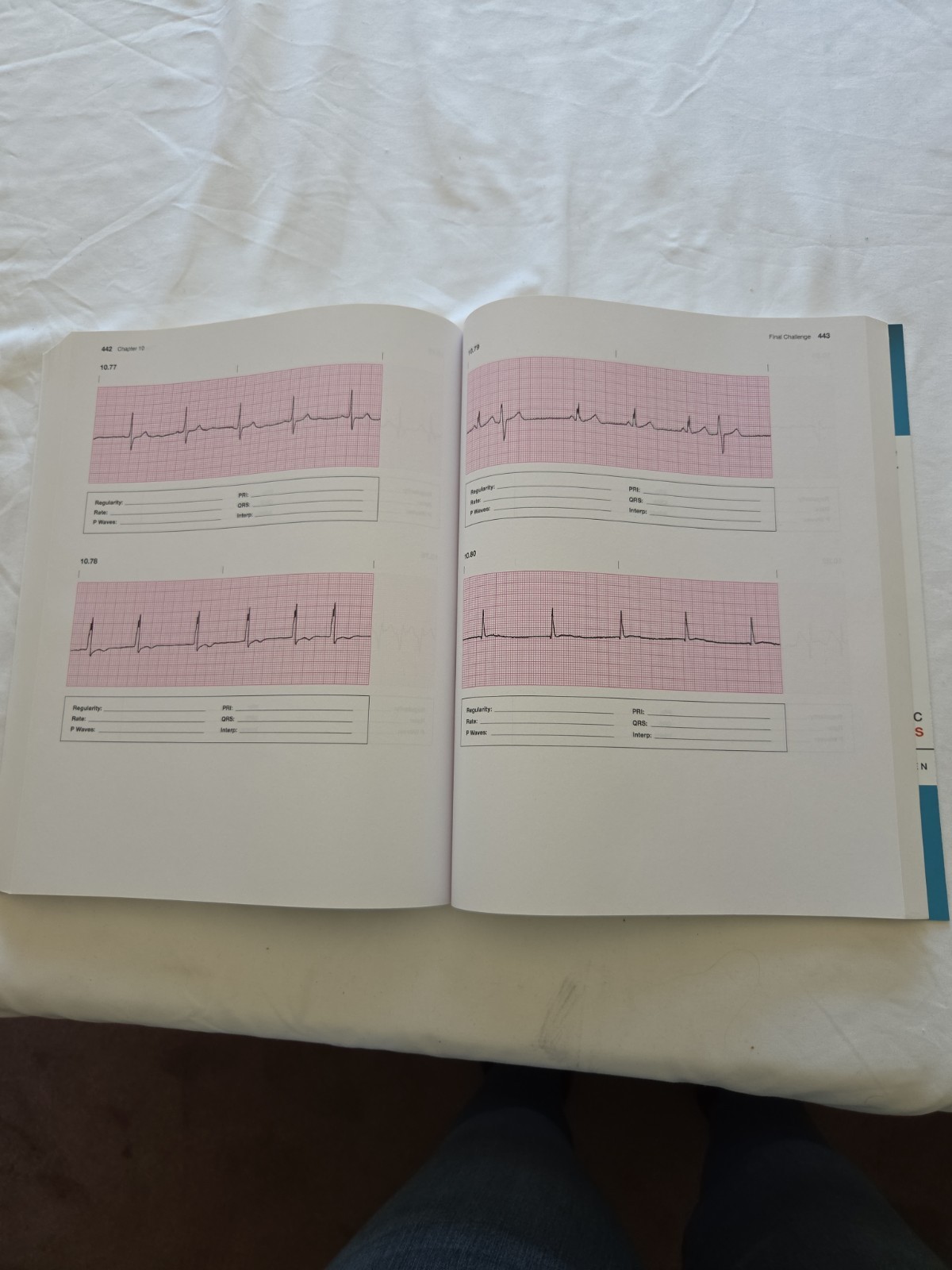 Basic Arrhythmias With 12-Lead EKGs 8th Edition Paperback By Walraven, Gail