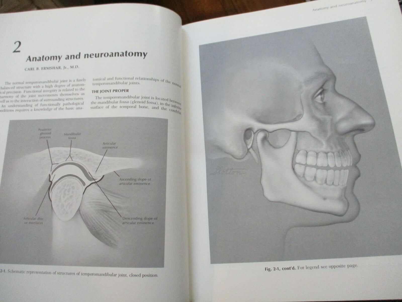 Diseases of the Tempormandibular Apparatus : A Multidisciplinary Approach 1977
