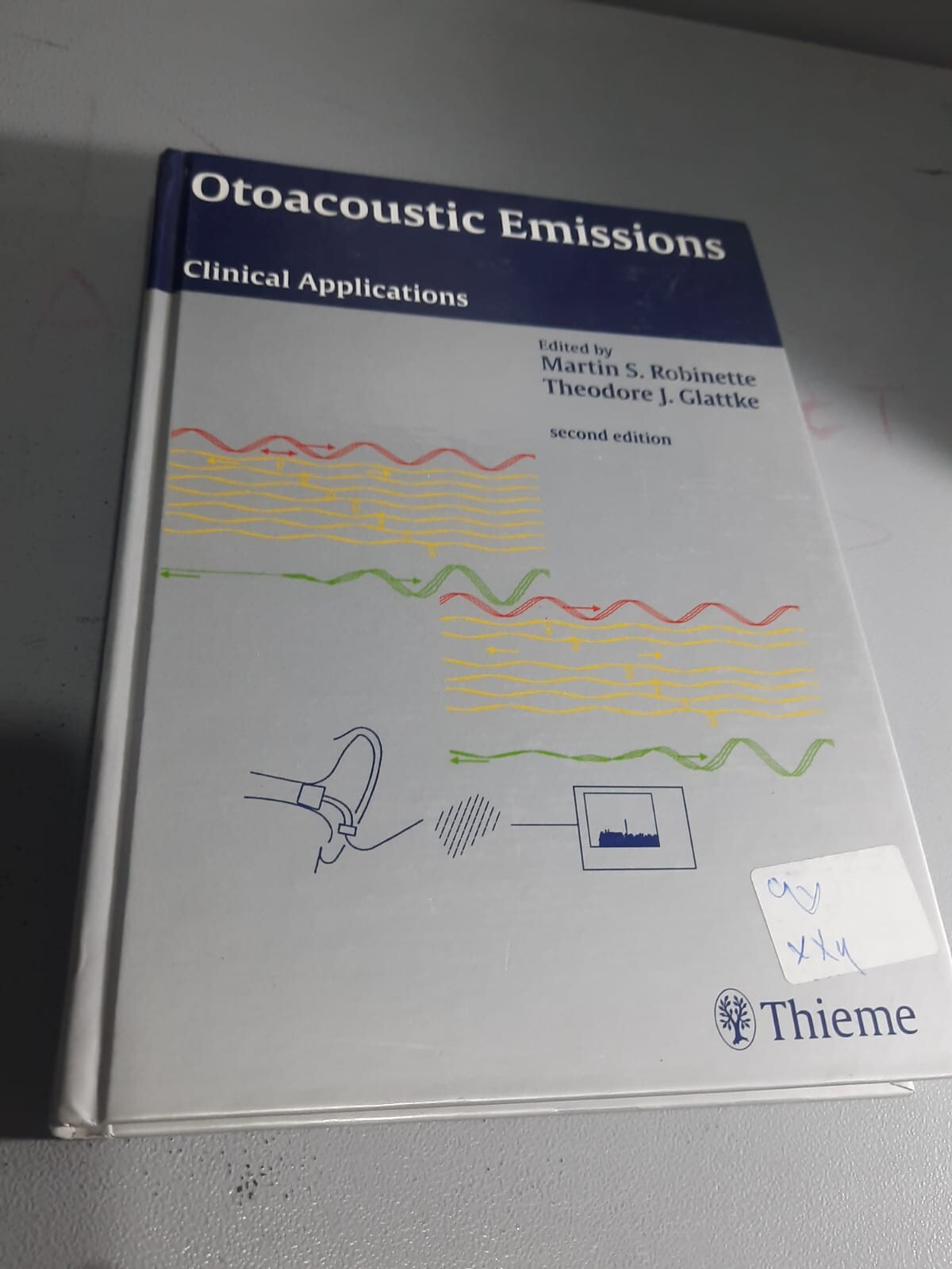 Otoacoustic Emissions
