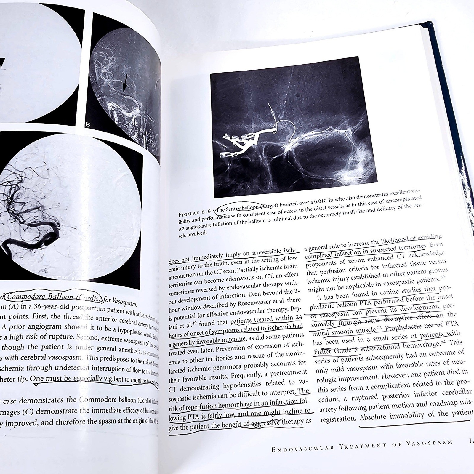 Springer Interventional Endovascular Therapy Nervous System Pearse Morris SZ VTG
