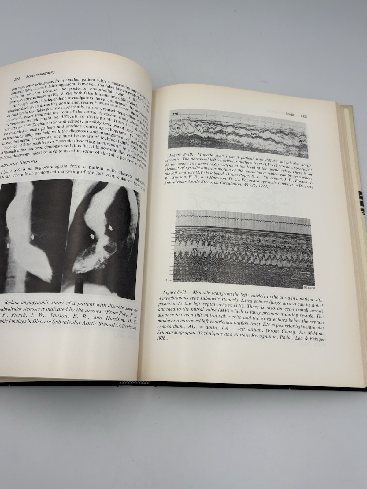 Echocardiography By Harvey Feinbaum (1976) Rare Vintage Hardcover