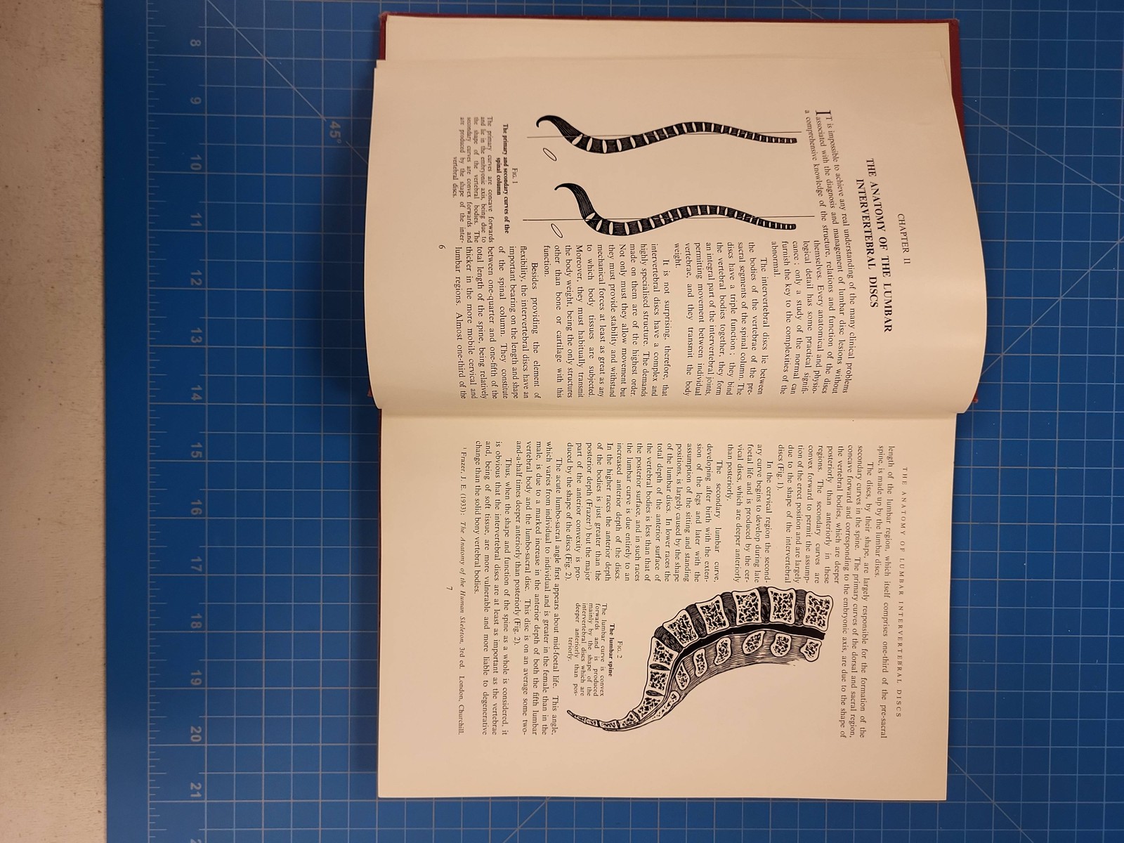 J R Armstrong Lumbar Disc Lesions 1958 Hardcover Second Edition Spine Sciatica
