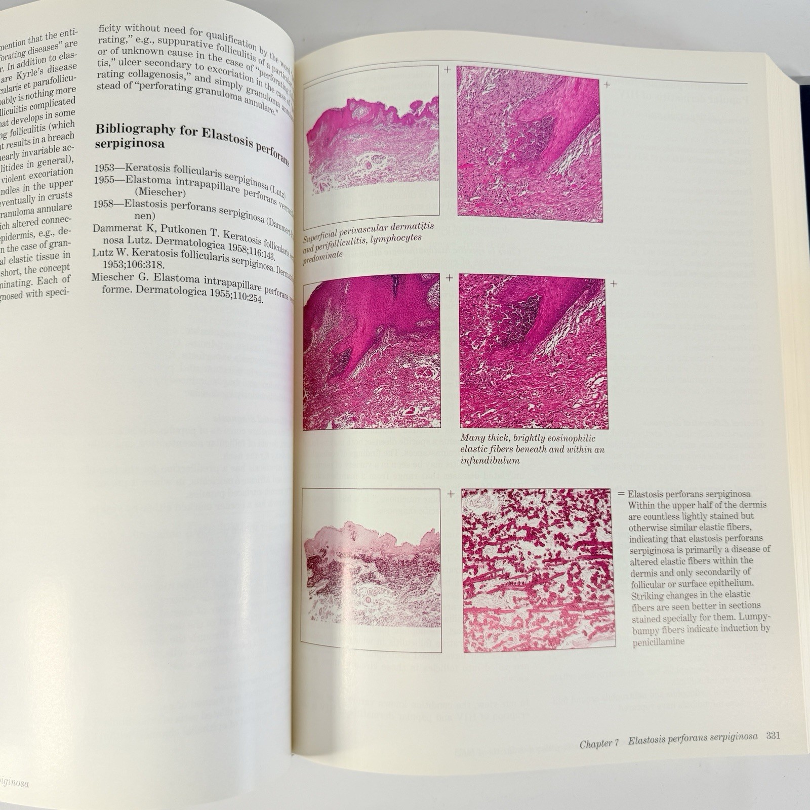 Histologic Diagnosis of Inflammatory Skin Diseases 2nd Ed Ackerman + Algorithms