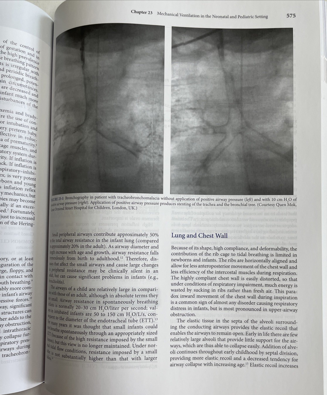 Principles And Practice of Mechanical Ventilation 3rd Edition Martin Tobin 2018