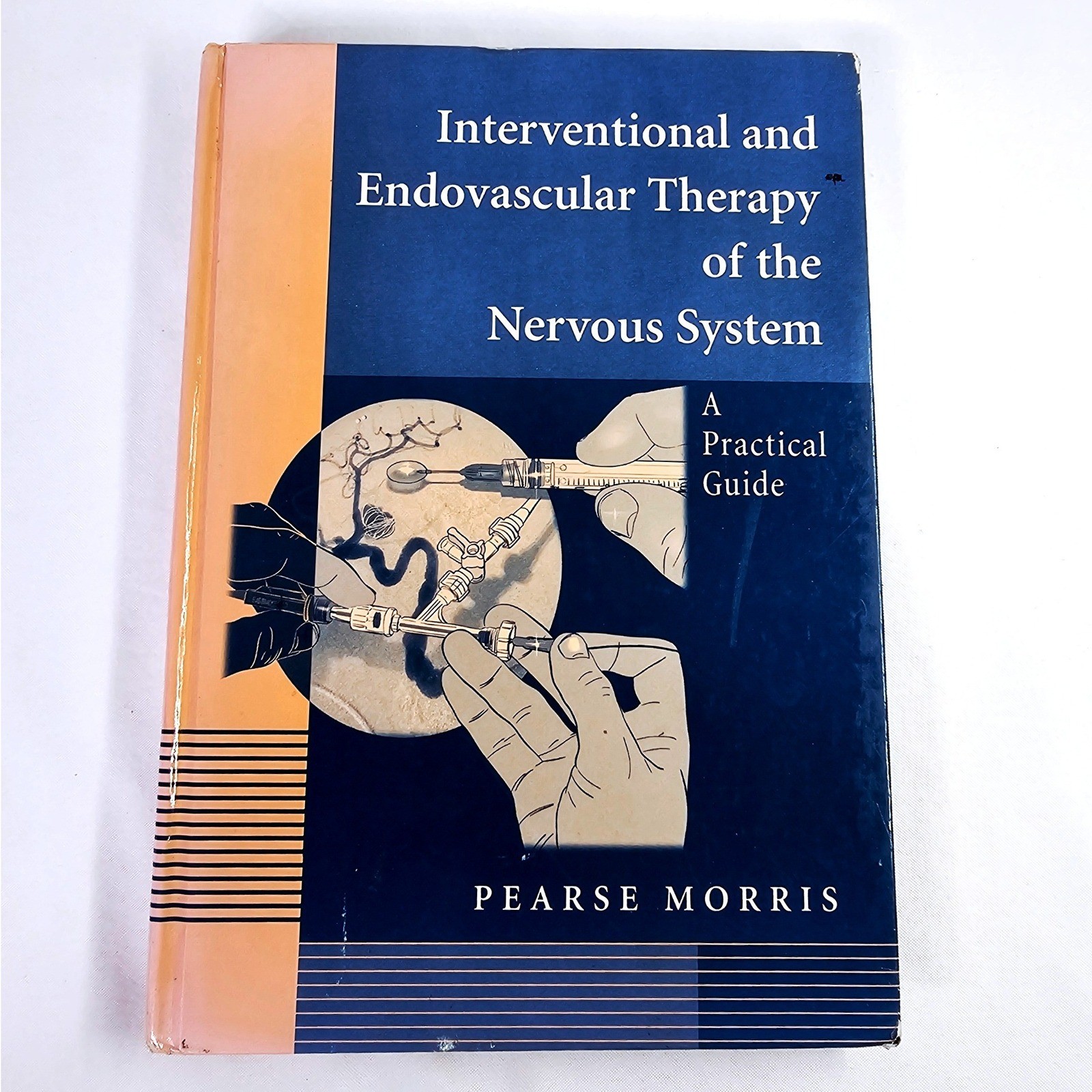 Springer Interventional Endovascular Therapy Nervous System Pearse Morris SZ VTG